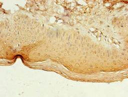 Immunohistochemistry of paraffin-embedded human skin tissue using CSB-PA012936LA01HU at dilution of 1:100