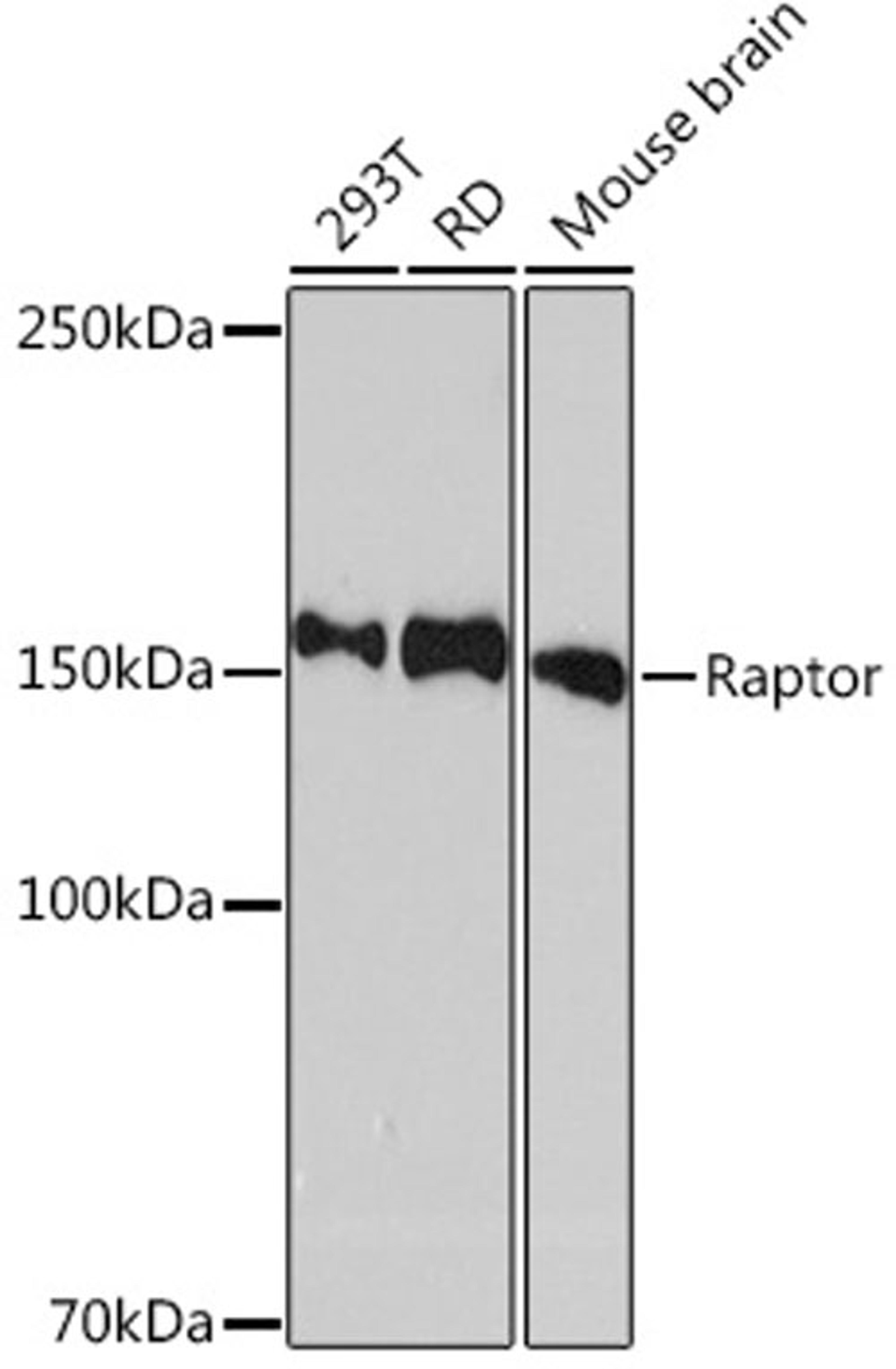 Western blot - Raptor Rabbit mAb (A8992)