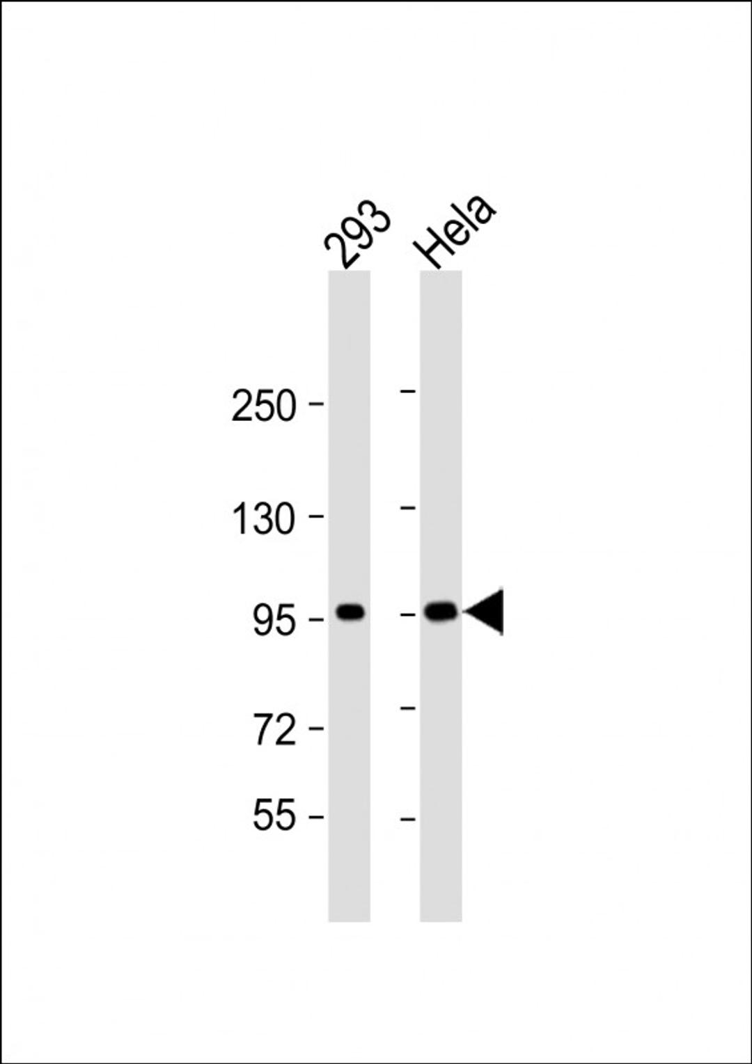 Western Blot at 1:1000 dilution Lane 1: 293 whole cell lysate Lane 2: Hela whole cell lysate Lysates/proteins at 20 ug per lane.