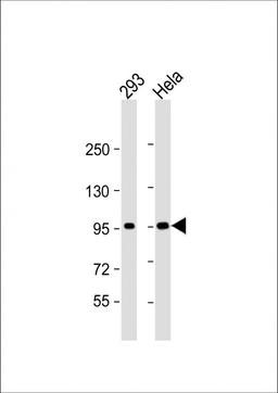 Western Blot at 1:1000 dilution Lane 1: 293 whole cell lysate Lane 2: Hela whole cell lysate Lysates/proteins at 20 ug per lane.