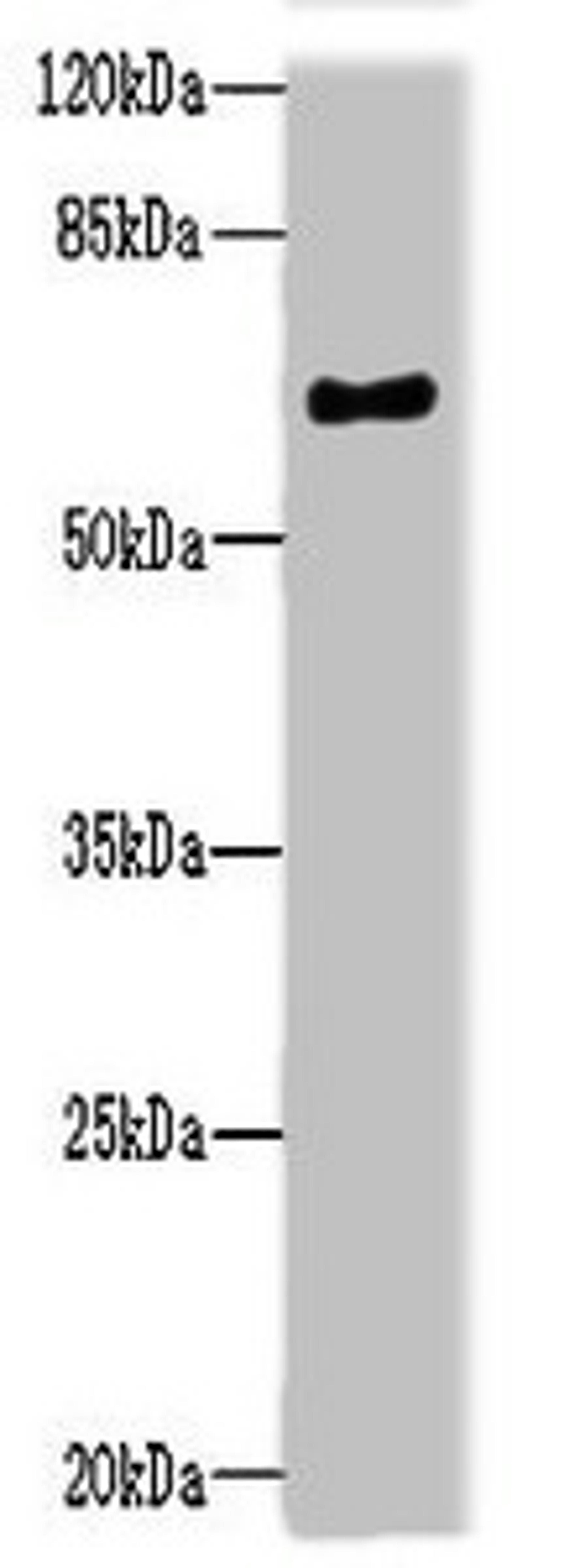 Western blot. All lanes: NRXN3 antibody at 2ug/ml + Mouse heart tissue. Secondary. Goat polyclonal to rabbit IgG at 1/10000 dilution. Predicted band size: 70, 48, 44, 51 kDa. Observed band size: 70 kDa.