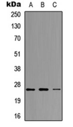 Western blot analysis of MCF7 (Lane 1), Raw264.7 (Lane 2), H9C2 (Lane 3) whole cell lysates using Neurogenin 1 antibody