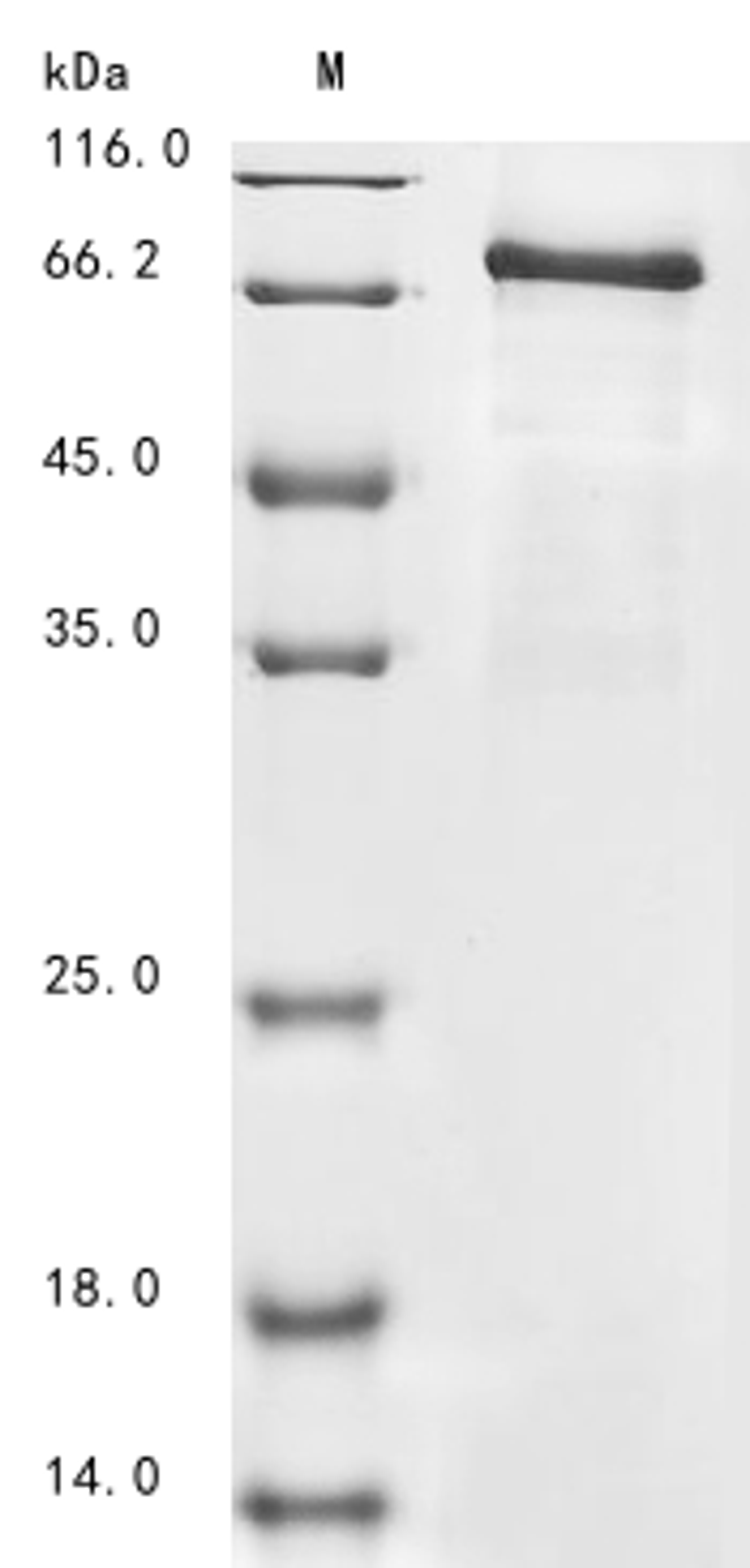 (Tris-Glycine gel) Discontinuous SDS-PAGE (reduced) with 5% enrichment gel and 15% separation gel.