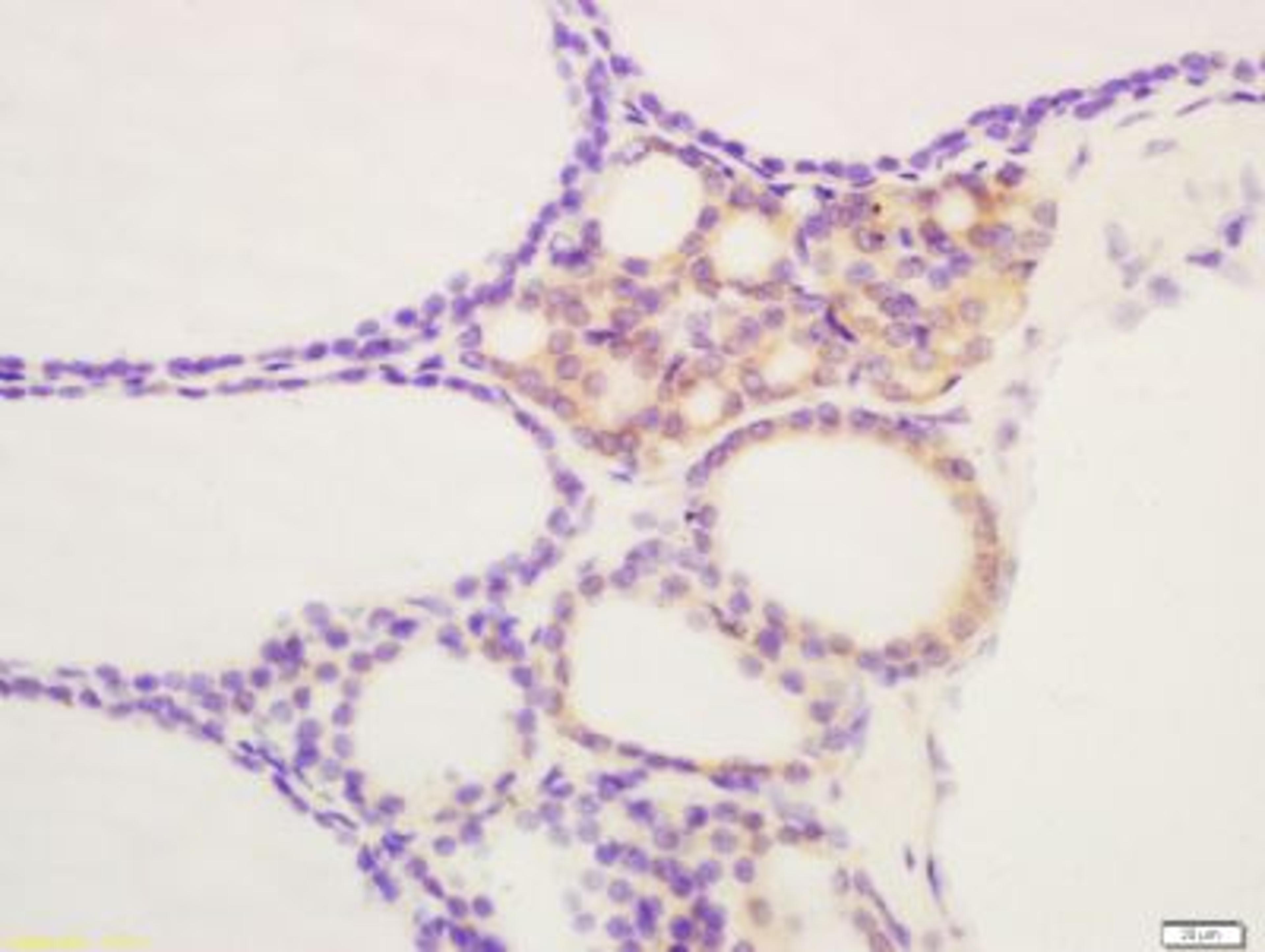 Immunohistochemical staining of rat thyroid tissue using TSHB antibody.