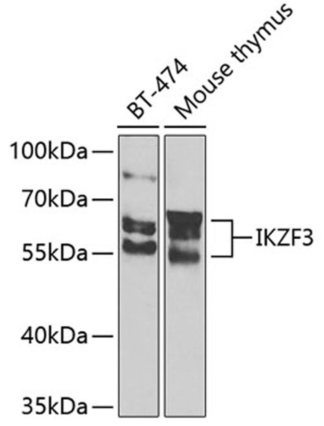 Western blot - IKZF3 Antibody (A7287)