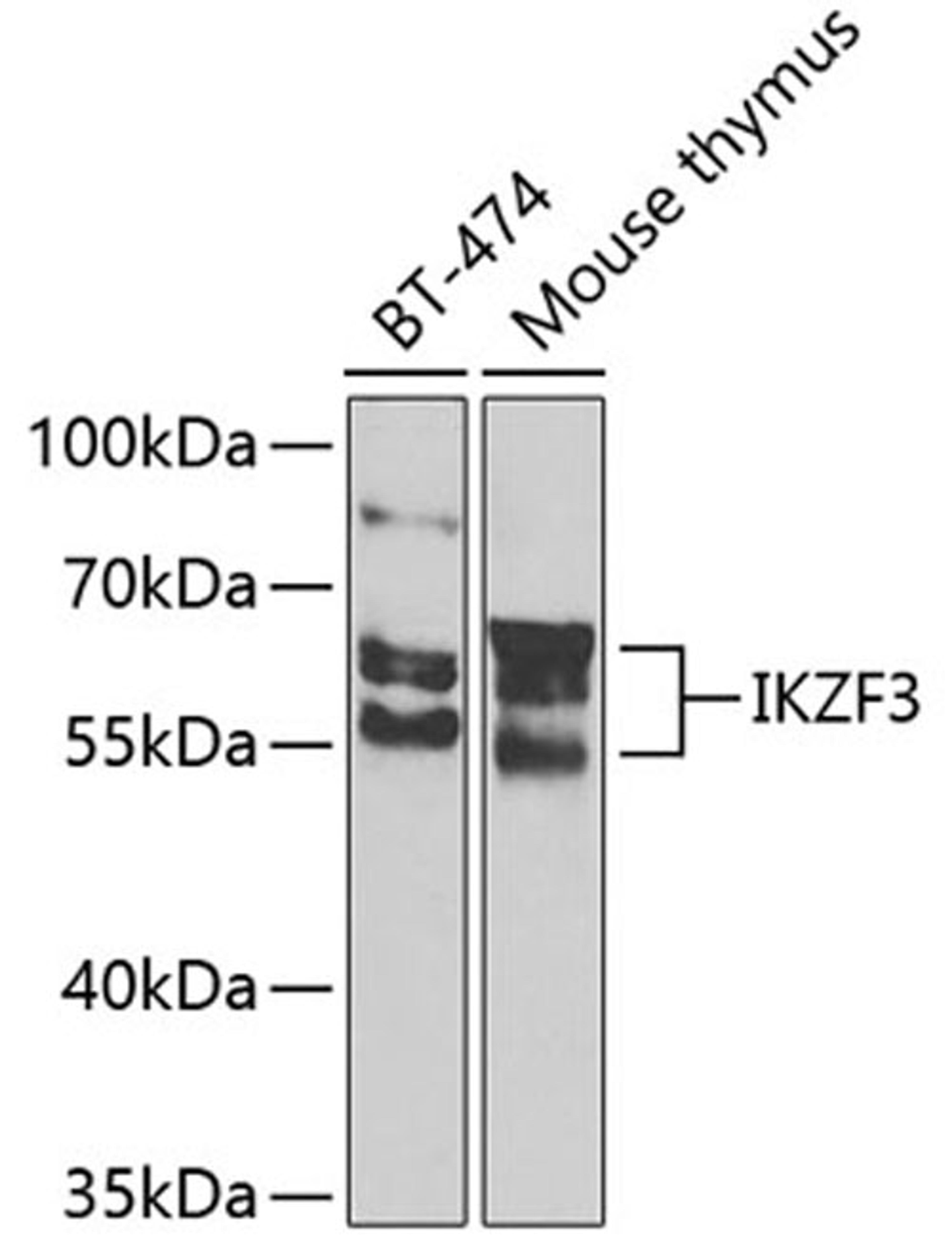 Western blot - IKZF3 Antibody (A7287)