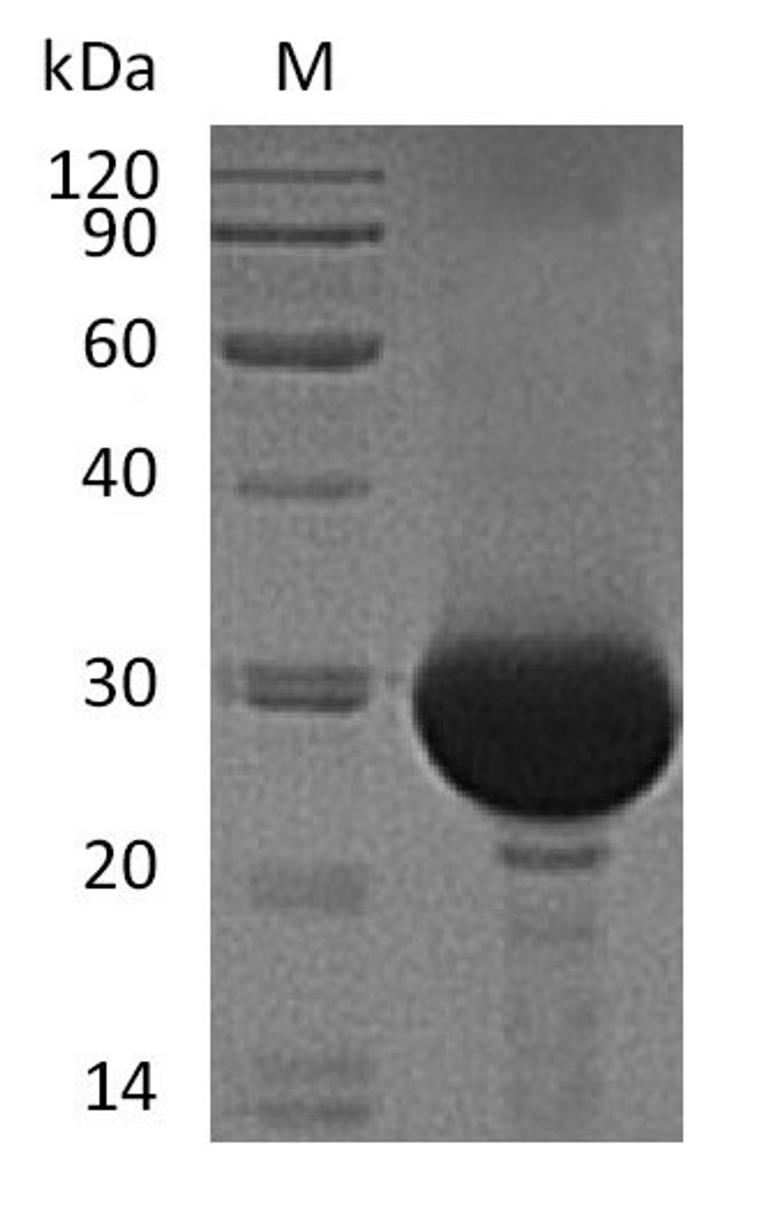 (Tris-Glycine gel) Discontinuous SDS-PAGE (reduced) with 5% enrichment gel and 15% separation gel.