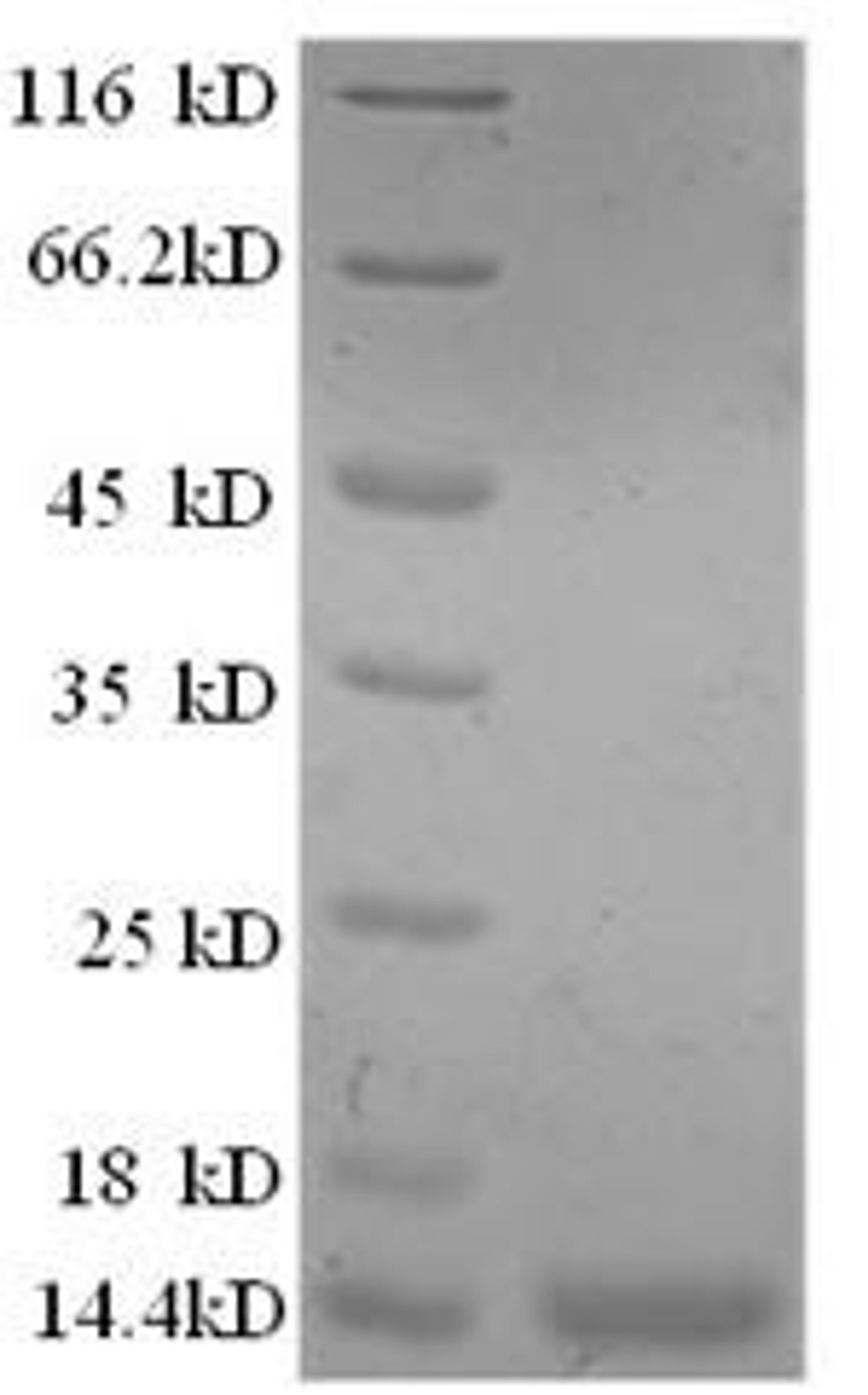 (Tris-Glycine gel) Discontinuous SDS-PAGE (reduced) with 5% enrichment gel and 15% separation gel.