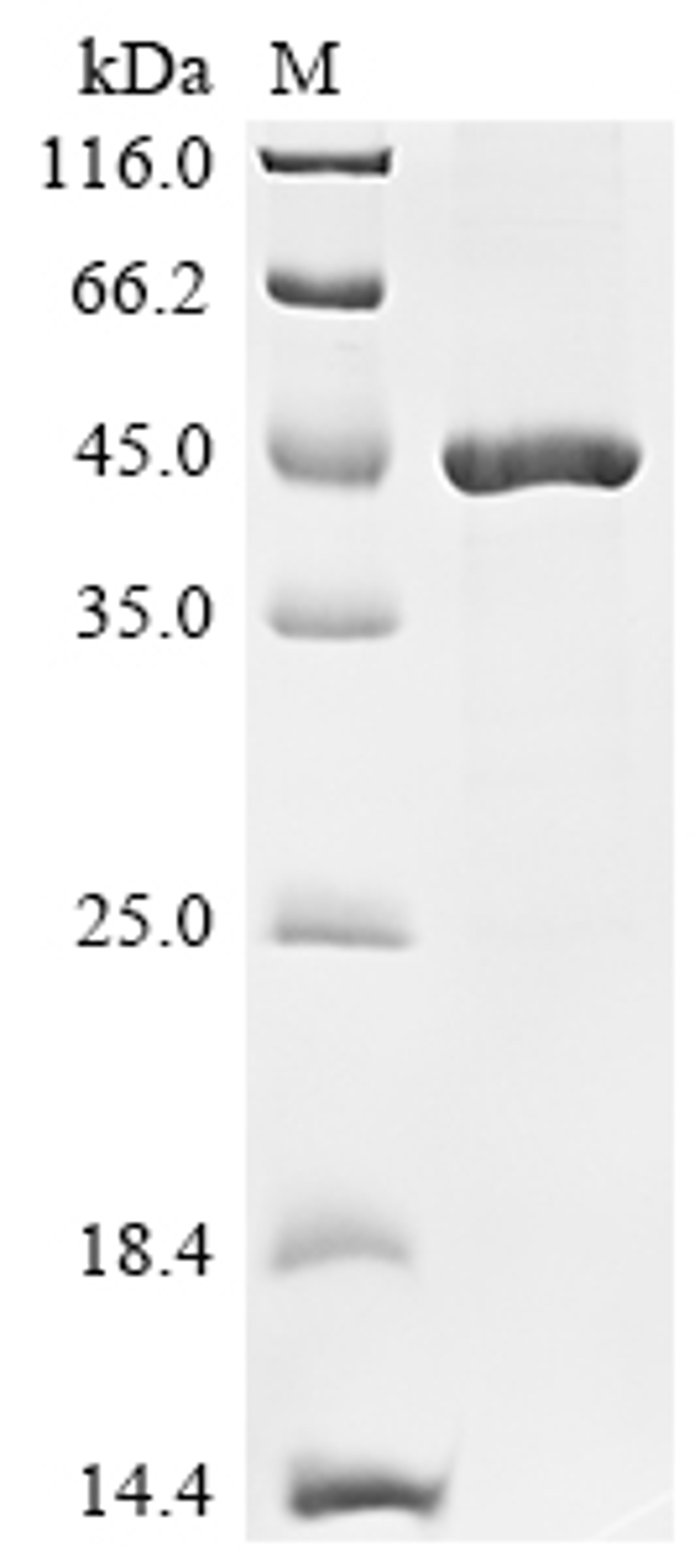 (Tris-Glycine gel) Discontinuous SDS-PAGE (reduced) with 5% enrichment gel and 15% separation gel.