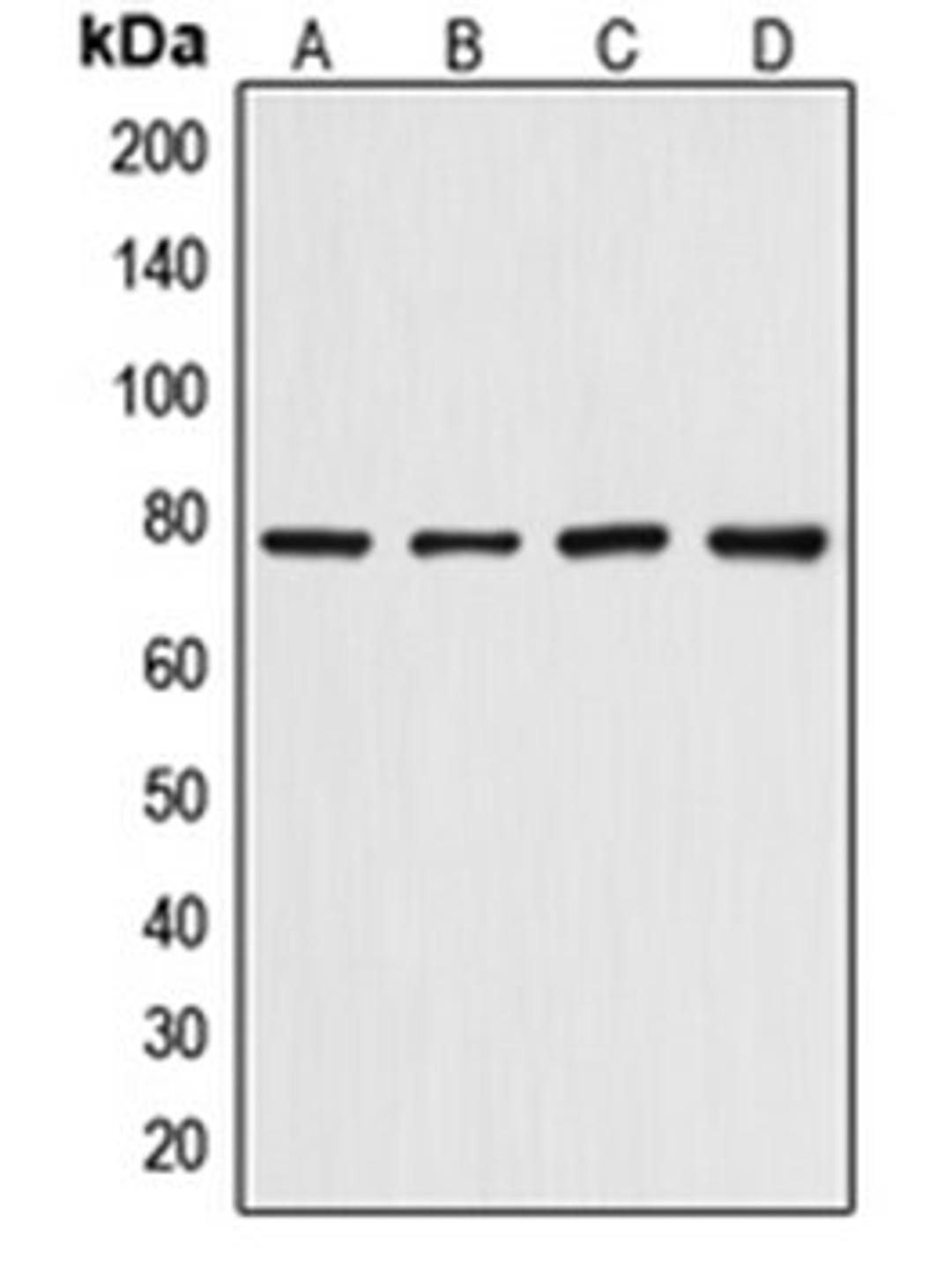 Western blot analysis of HepG2 (Lane 1), HeLa (Lane 2), mouse skeletal muscle (Lane 3), rat skeletal muscle (Lane 4) whole cell lysates using DCLRE1C antibody