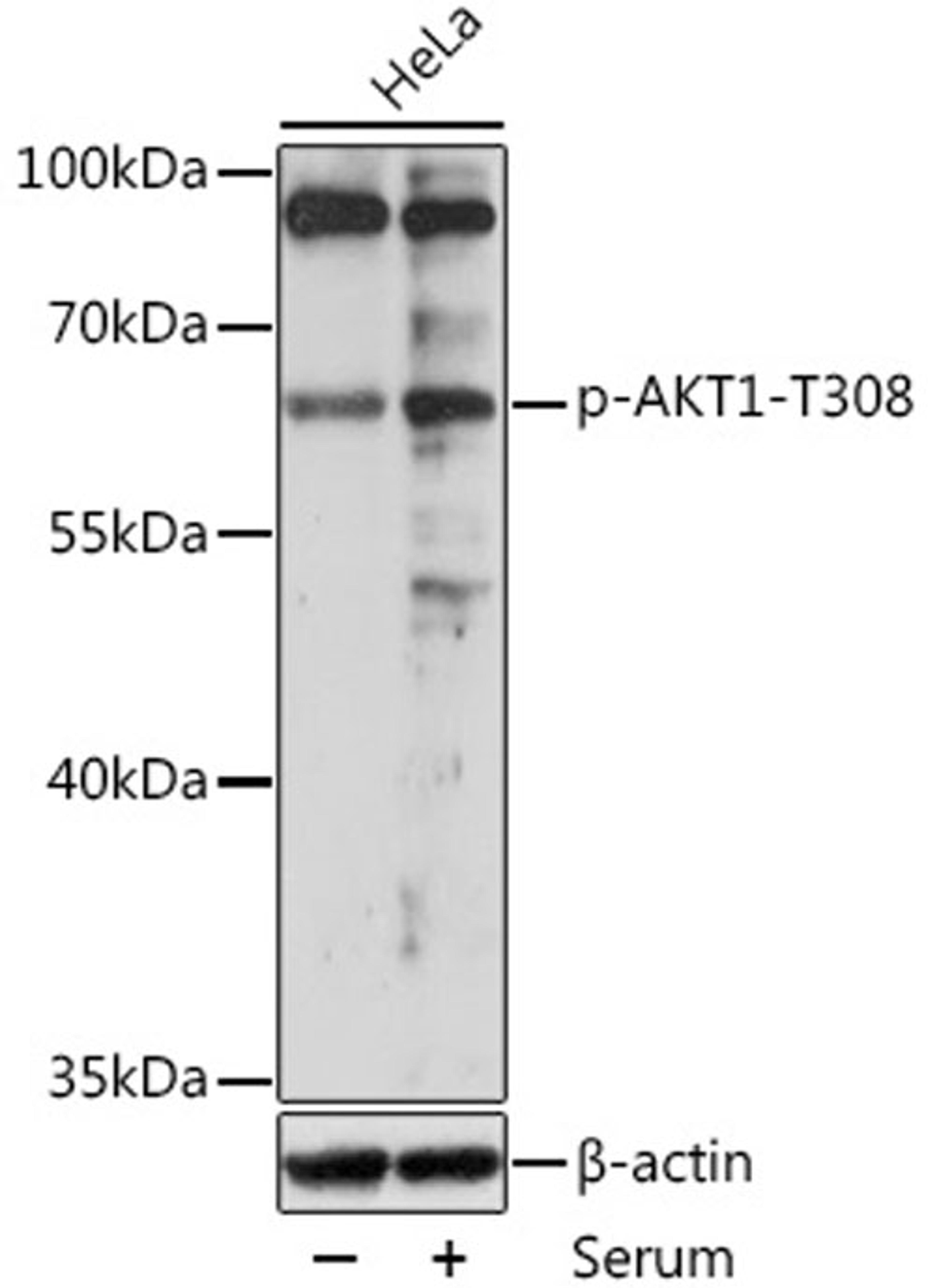 Western blot - Phospho-AKT1-T308 antibody (AP0304)