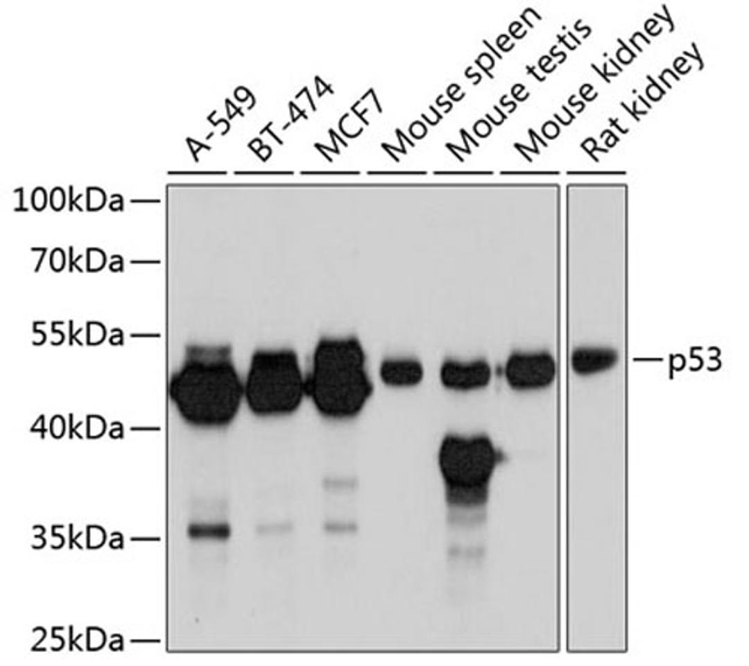 Western blot - p53 antibody (A5761)