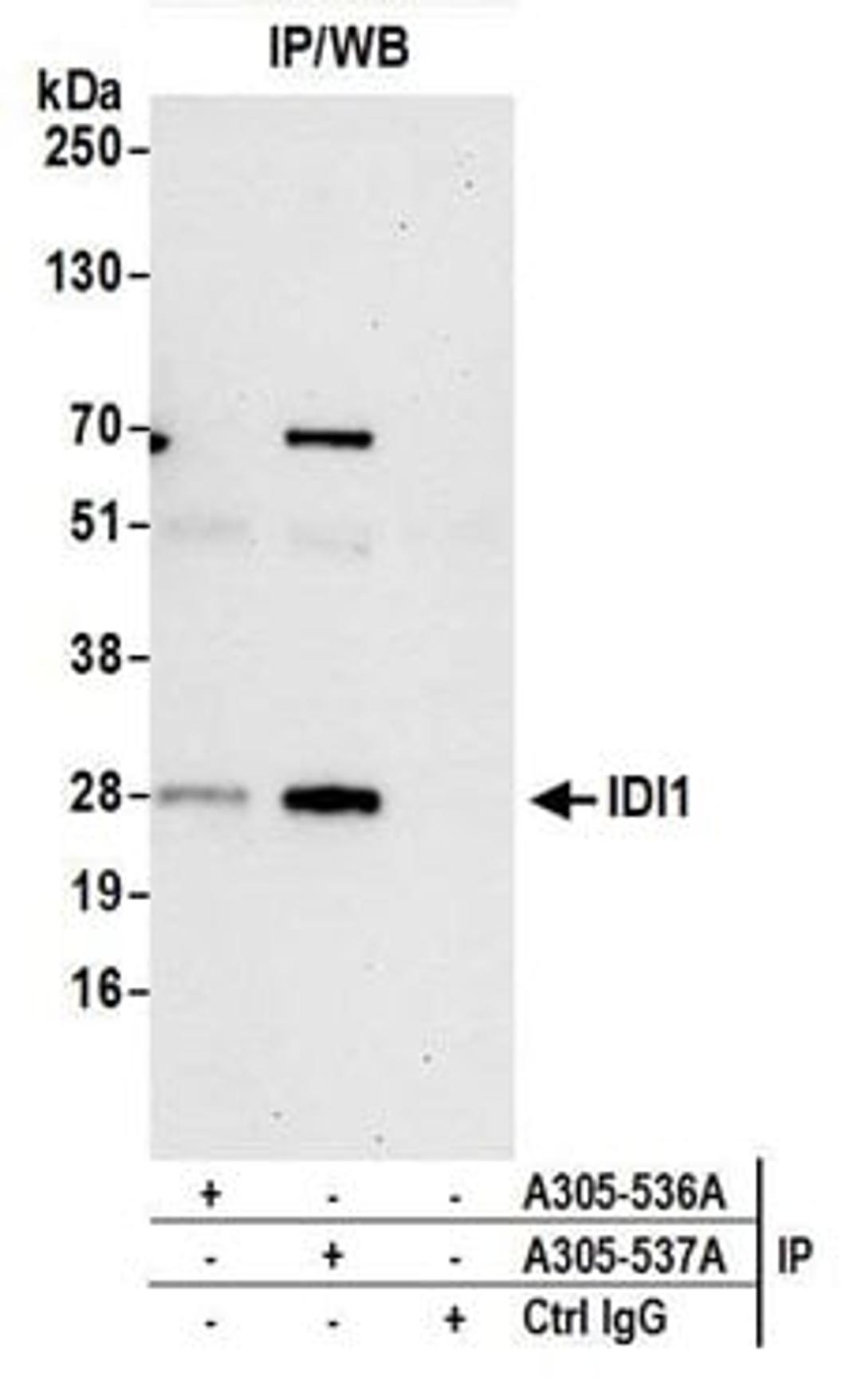 Detection of human IDI1 by western blot of immunoprecipitates.