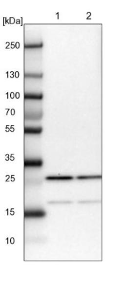 Western Blot: CGGBP1 Antibody [NBP1-84528] - Lane 1: NIH-3T3 cell lysate (Mouse embryonic fibroblast cells)<br/>Lane 2: NBT-II cell lysate (Rat Wistar bladder tumour cells)