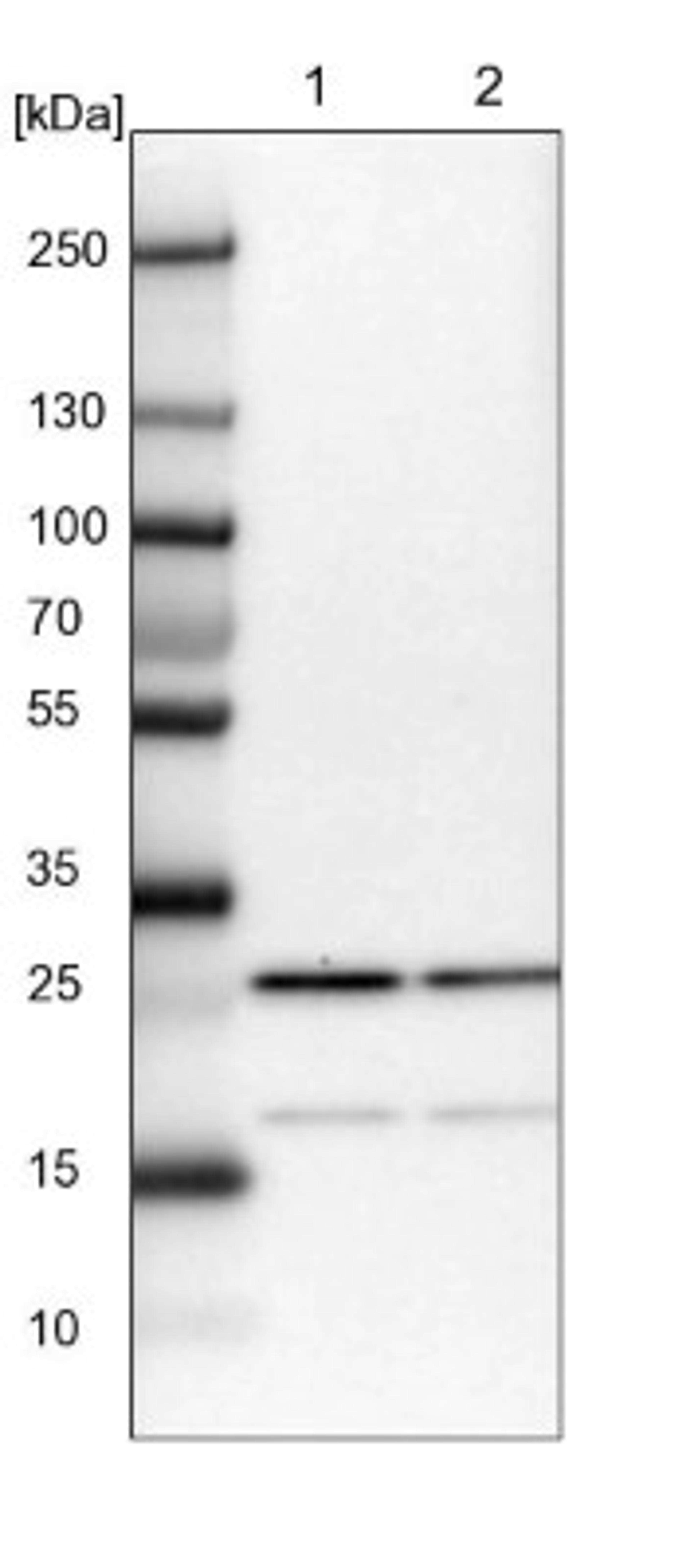 Western Blot: CGGBP1 Antibody [NBP1-84528] - Lane 1: NIH-3T3 cell lysate (Mouse embryonic fibroblast cells)<br/>Lane 2: NBT-II cell lysate (Rat Wistar bladder tumour cells)