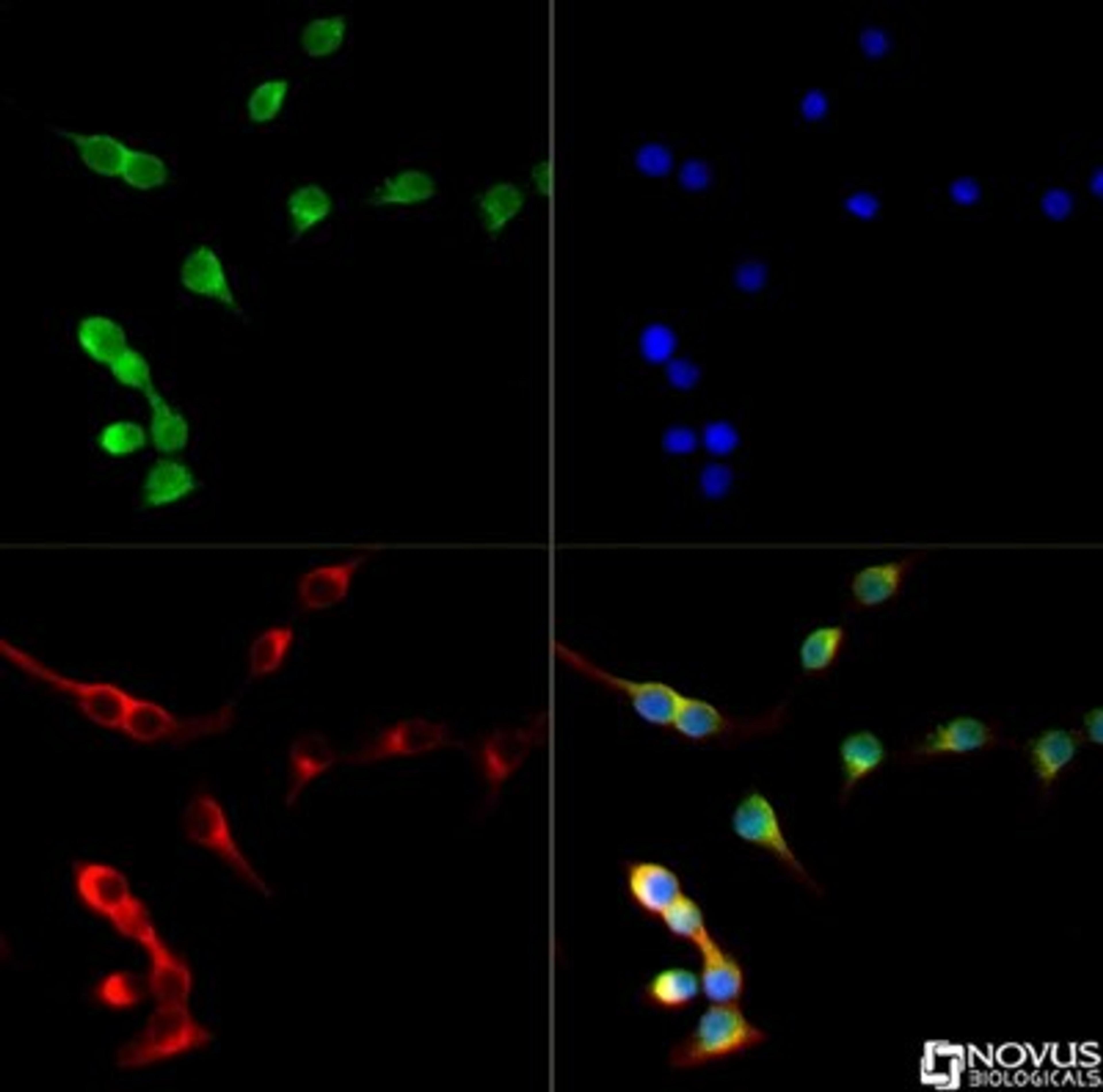 Immunocytochemistry/Immunofluorescence: NKX6.1 Antibody [NBP1-49672] - Nkx6.1 antibody was tested at 1:250 in INS-1 cells with Dylight 488 (green). Nuclei and alpha-tubulin were counterstained with DAPI (blue) and Dylight 550 (red). Image objective 40x.