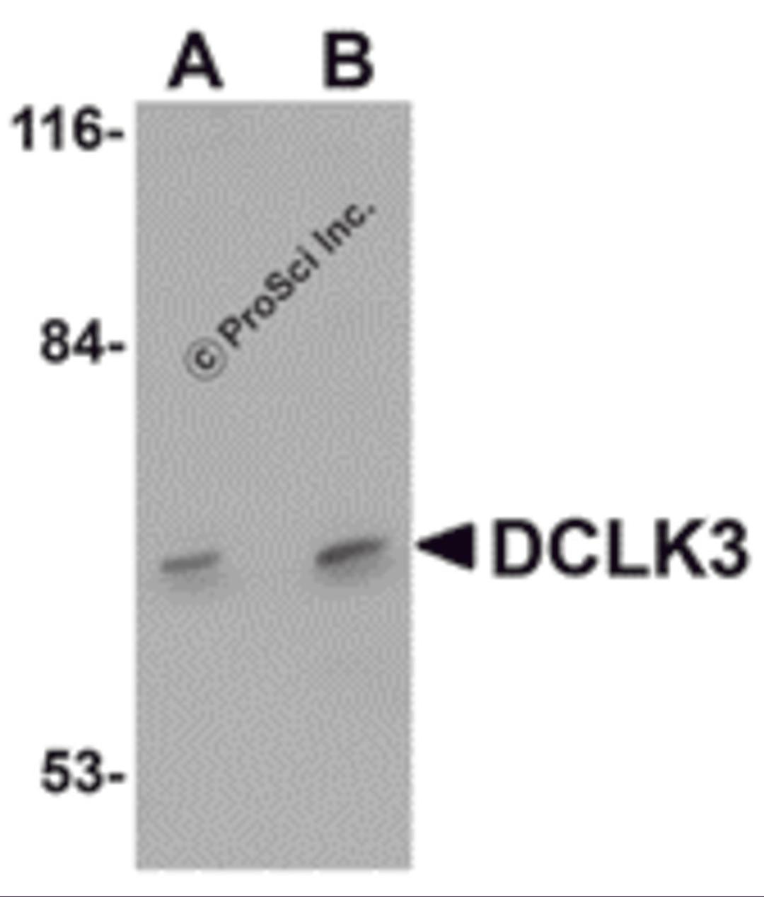 Western blot analysis of DCLK3 in K562 cell lysate with DCLK3 antibody at (A) 1 and (B) 2 &#956;g/mL.