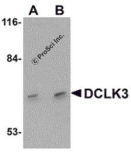 Western blot analysis of DCLK3 in K562 cell lysate with DCLK3 antibody at (A) 1 and (B) 2 μg/mL.