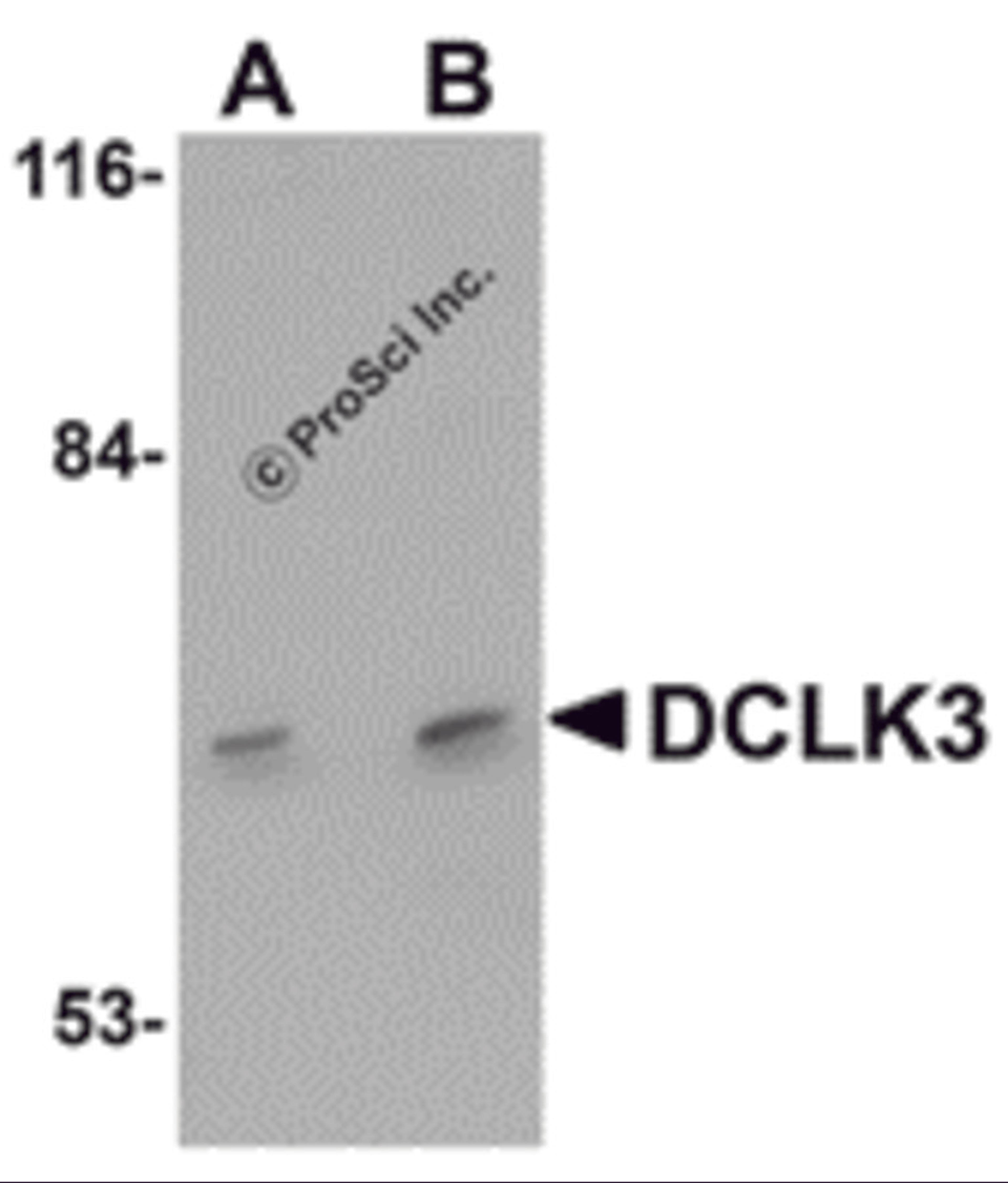 Western blot analysis of DCLK3 in K562 cell lysate with DCLK3 antibody at (A) 1 and (B) 2 μg/mL.