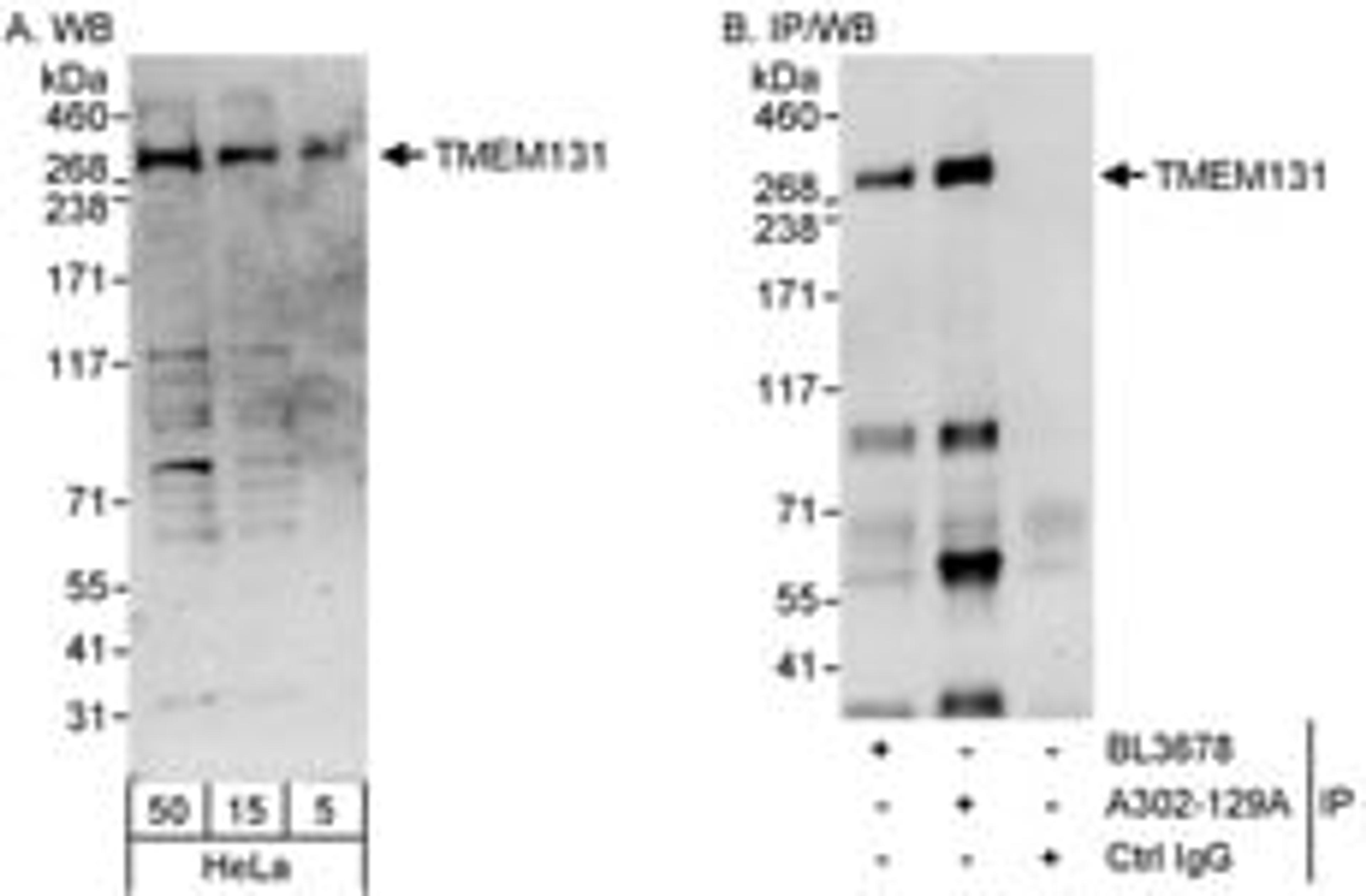 Detection of human TMEM131 by western blot and immunoprecipitation.