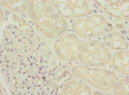 Immunohistochemistry of paraffin-embedded human kidney tissue using CSB-PA800100ESR2HU at dilution of 1:100