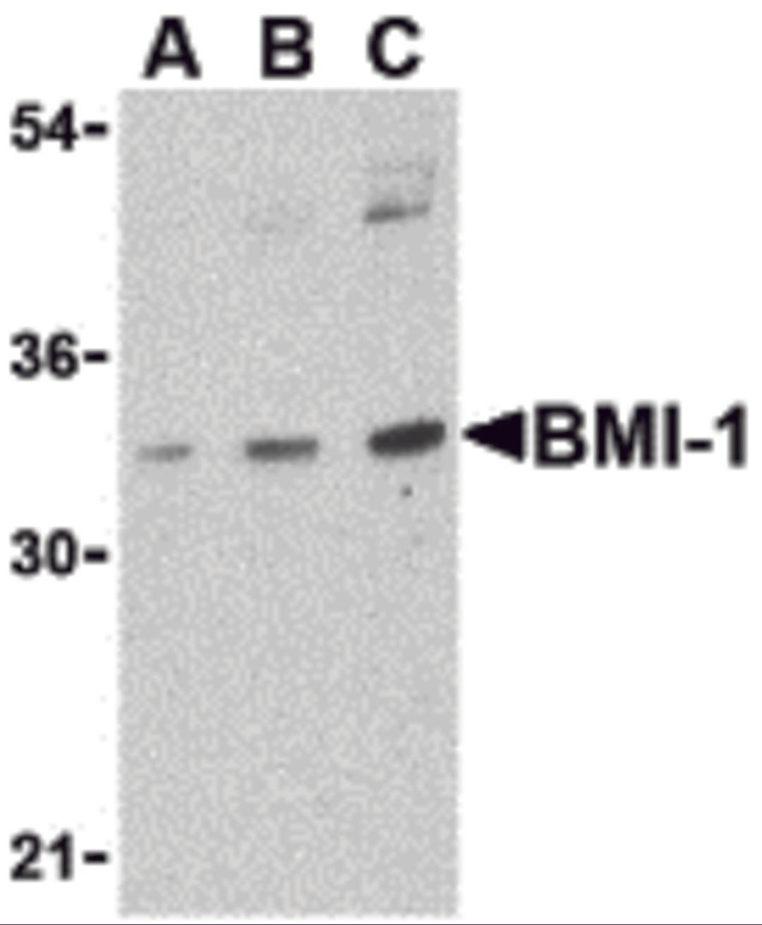 Western blot analysis of BMI-1 in K562 cell lysate with BMI-1 antibody at (A) 0.5, (B) 1 and (C) 2 &#956;g/mL.