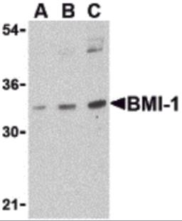 Western blot analysis of BMI-1 in K562 cell lysate with BMI-1 antibody at (A) 0.5, (B) 1 and (C) 2 &#956;g/mL.