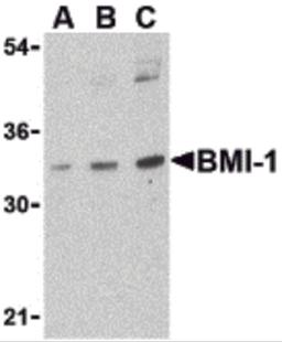 Western blot analysis of BMI-1 in K562 cell lysate with BMI-1 antibody at (A) 0.5, (B) 1 and (C) 2 μg/mL.