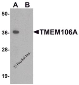 Western blot analysis of TMEM106A in A-20 cell lysate with TMEM106A antibody at 1 &#956;g/mL in (A) the absence and (B) the presence of blocking peptide.