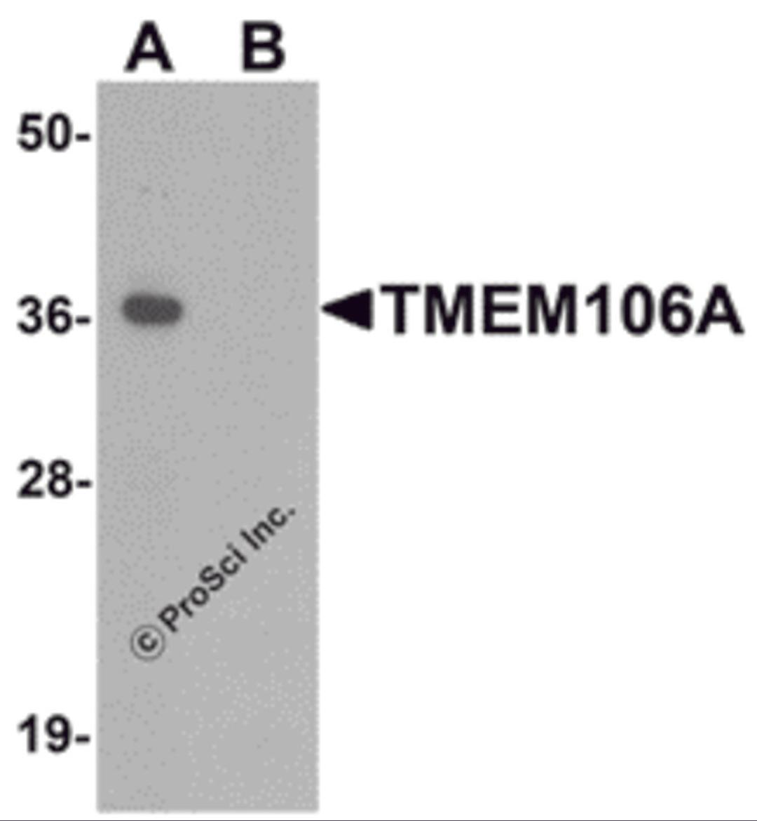 Western blot analysis of TMEM106A in A-20 cell lysate with TMEM106A antibody at 1 μg/mL in (A) the absence and (B) the presence of blocking peptide.
