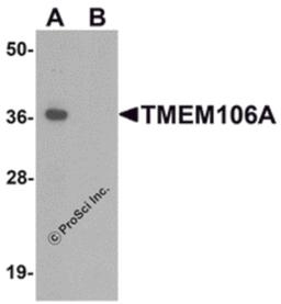 Western blot analysis of TMEM106A in A-20 cell lysate with TMEM106A antibody at 1 μg/mL in (A) the absence and (B) the presence of blocking peptide.