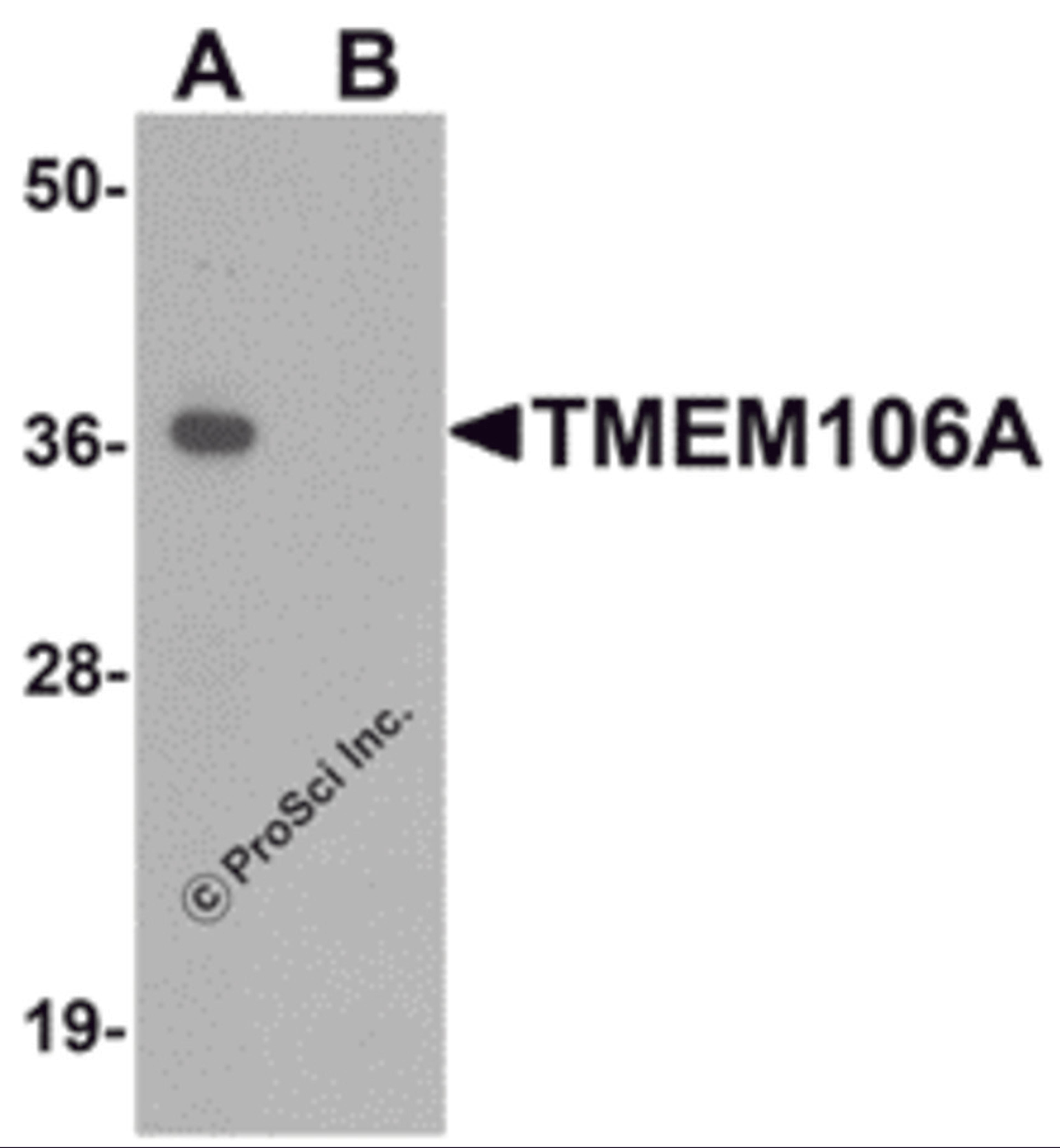 Western blot analysis of TMEM106A in A-20 cell lysate with TMEM106A antibody at 1 μg/mL in (A) the absence and (B) the presence of blocking peptide.