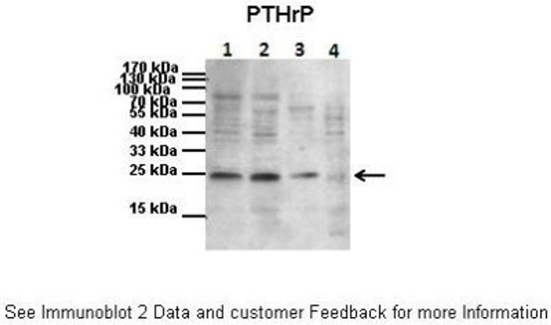 Western Blot: PTHLH/PTHrP Antibody [NBP1-59322] - Primary, Antibody Dilution: 1 : 1000 Secondary Antibody: Goat anti-rabbit HRP Secondary, Antibody Dilution: 1 : 2000.