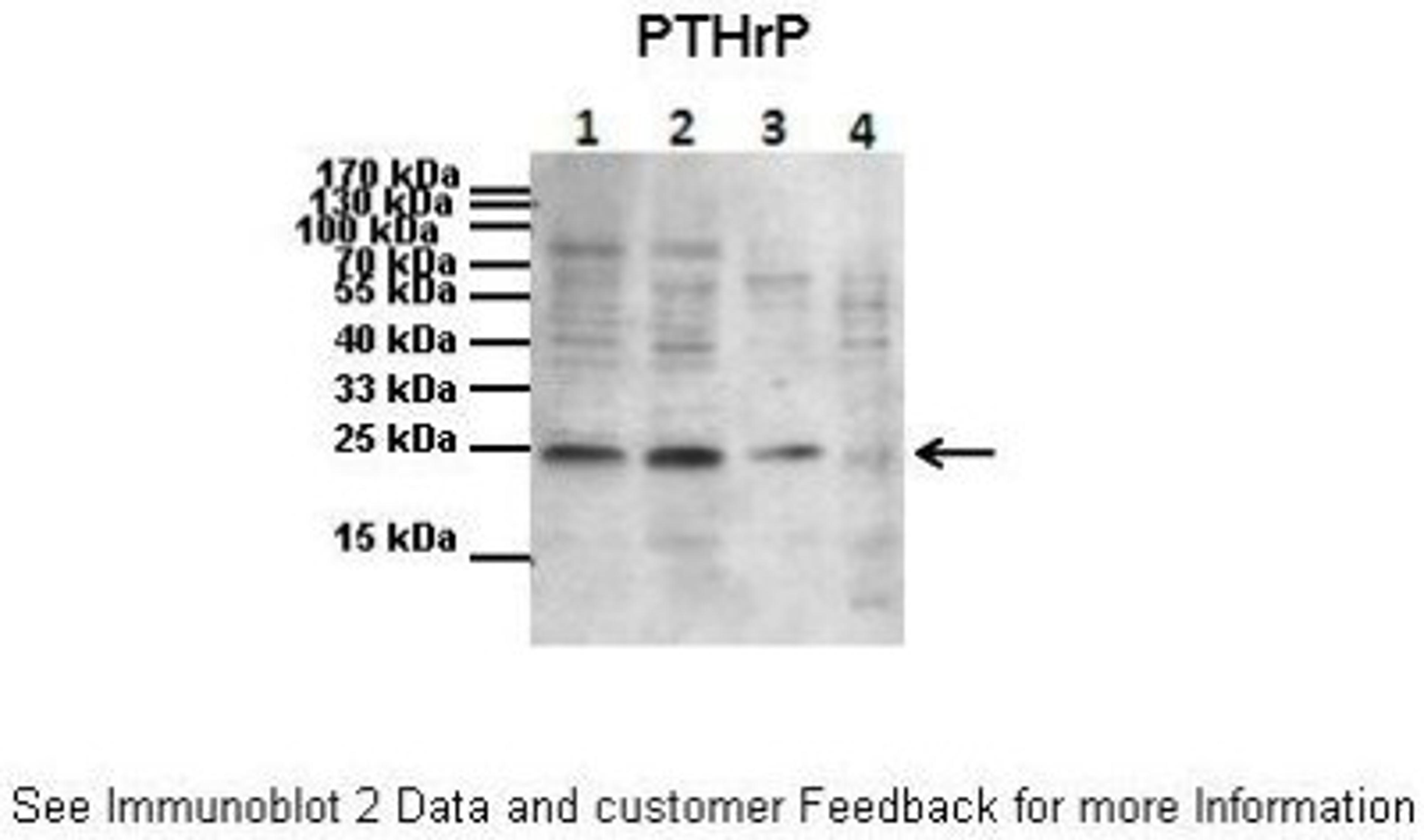 Western Blot: PTHLH/PTHrP Antibody [NBP1-59322] - Primary, Antibody Dilution: 1 : 1000 Secondary Antibody: Goat anti-rabbit HRP Secondary, Antibody Dilution: 1 : 2000.