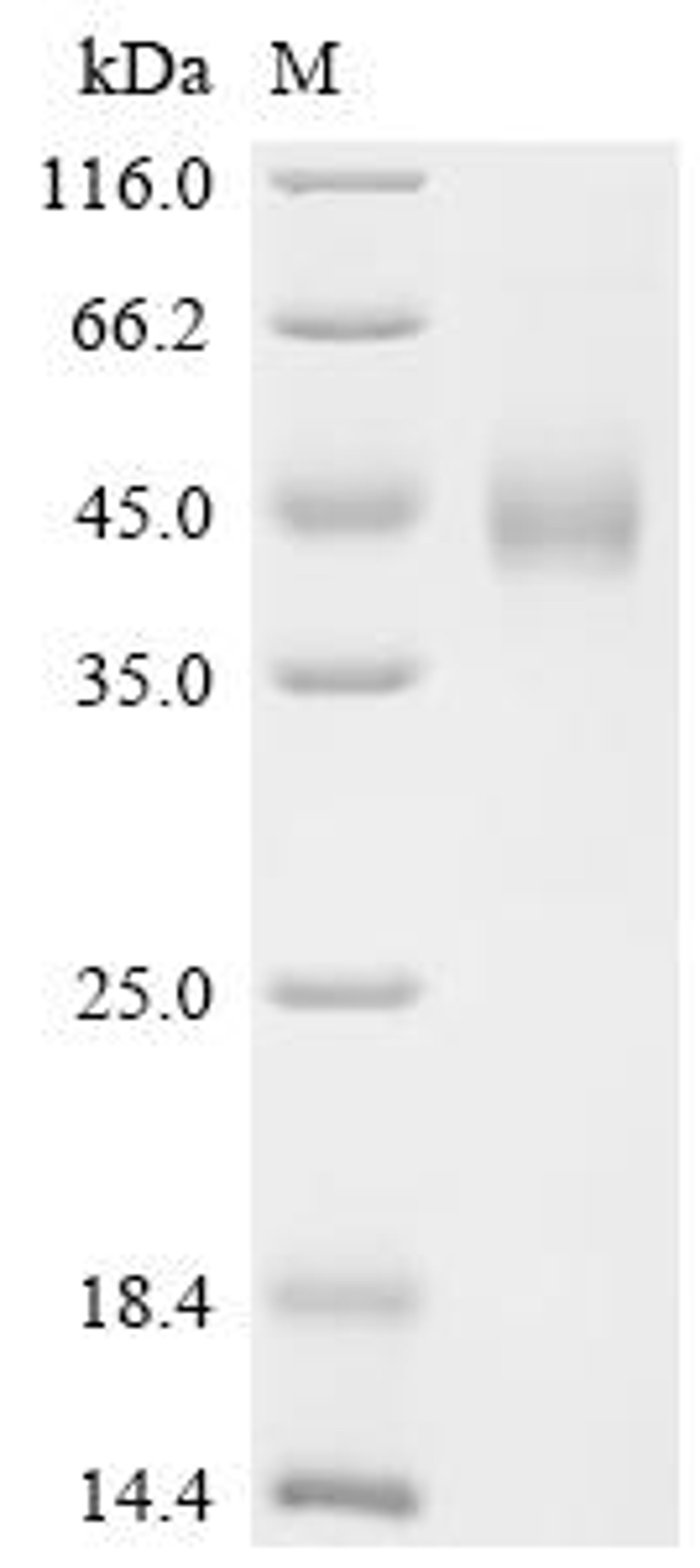 (Tris-Glycine gel) Discontinuous SDS-PAGE (reduced) with 5% enrichment gel and 15% separation gel.