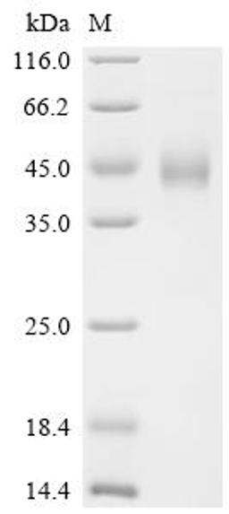 (Tris-Glycine gel) Discontinuous SDS-PAGE (reduced) with 5% enrichment gel and 15% separation gel.