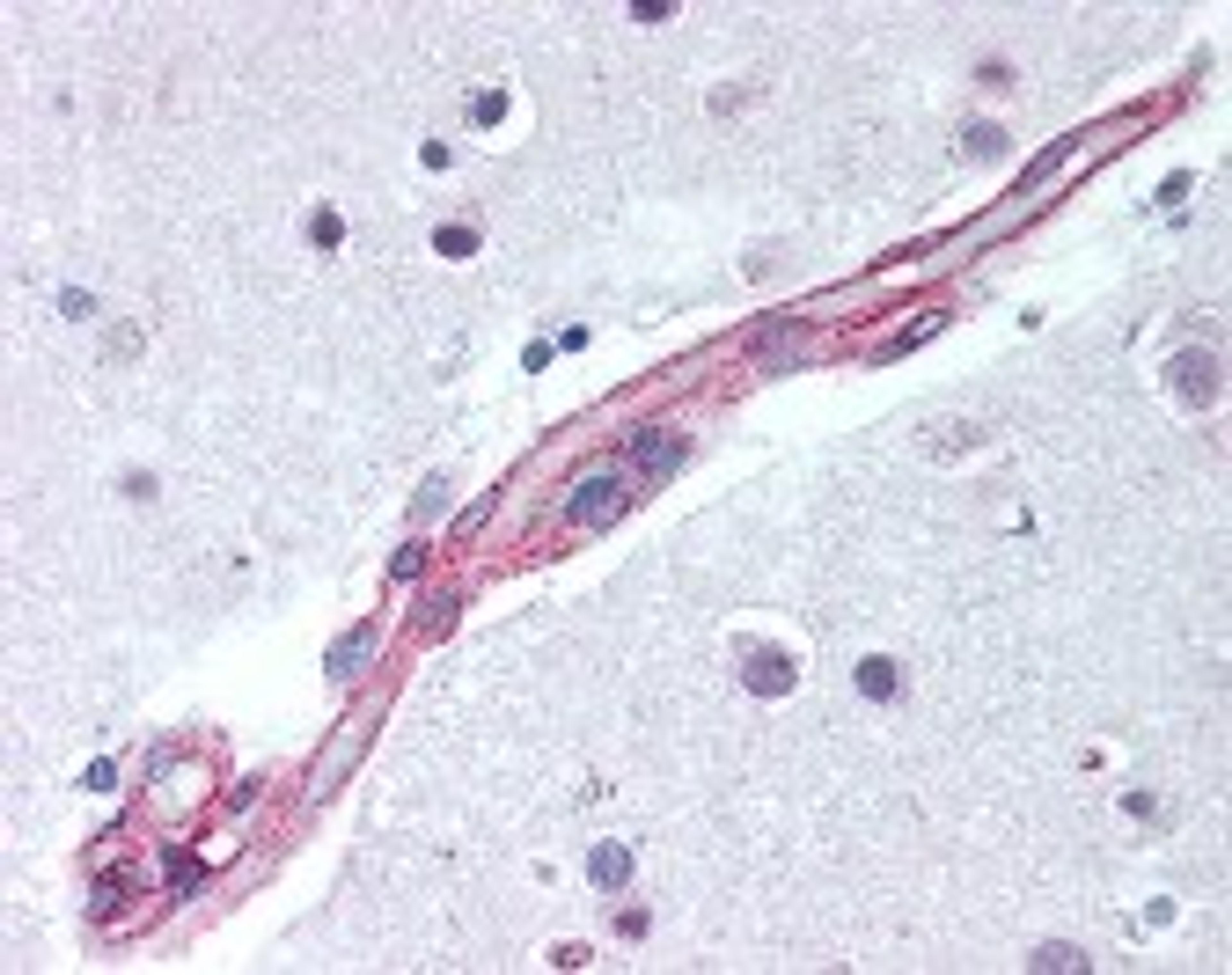 Immunohistochemistry staining of MAPK9 in brain cortex, capillary tissue using MAPK9 Antibody.