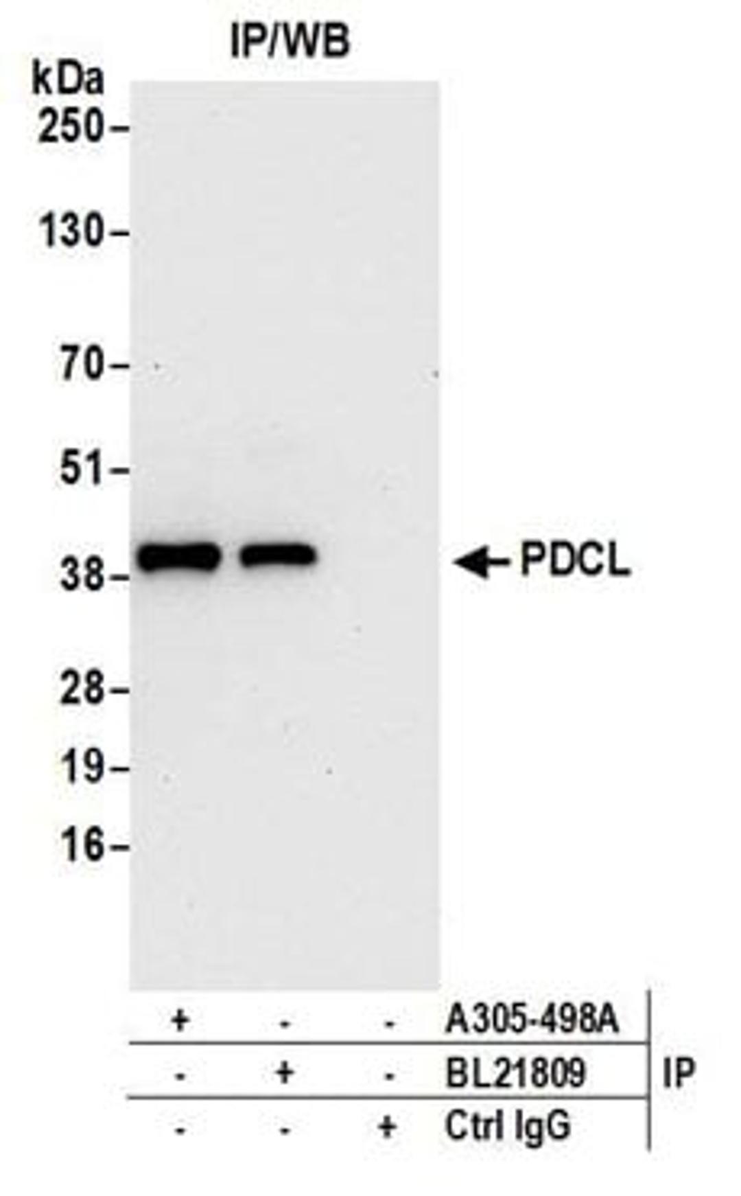 Detection of human PDCL by western blot of immunoprecipitates.