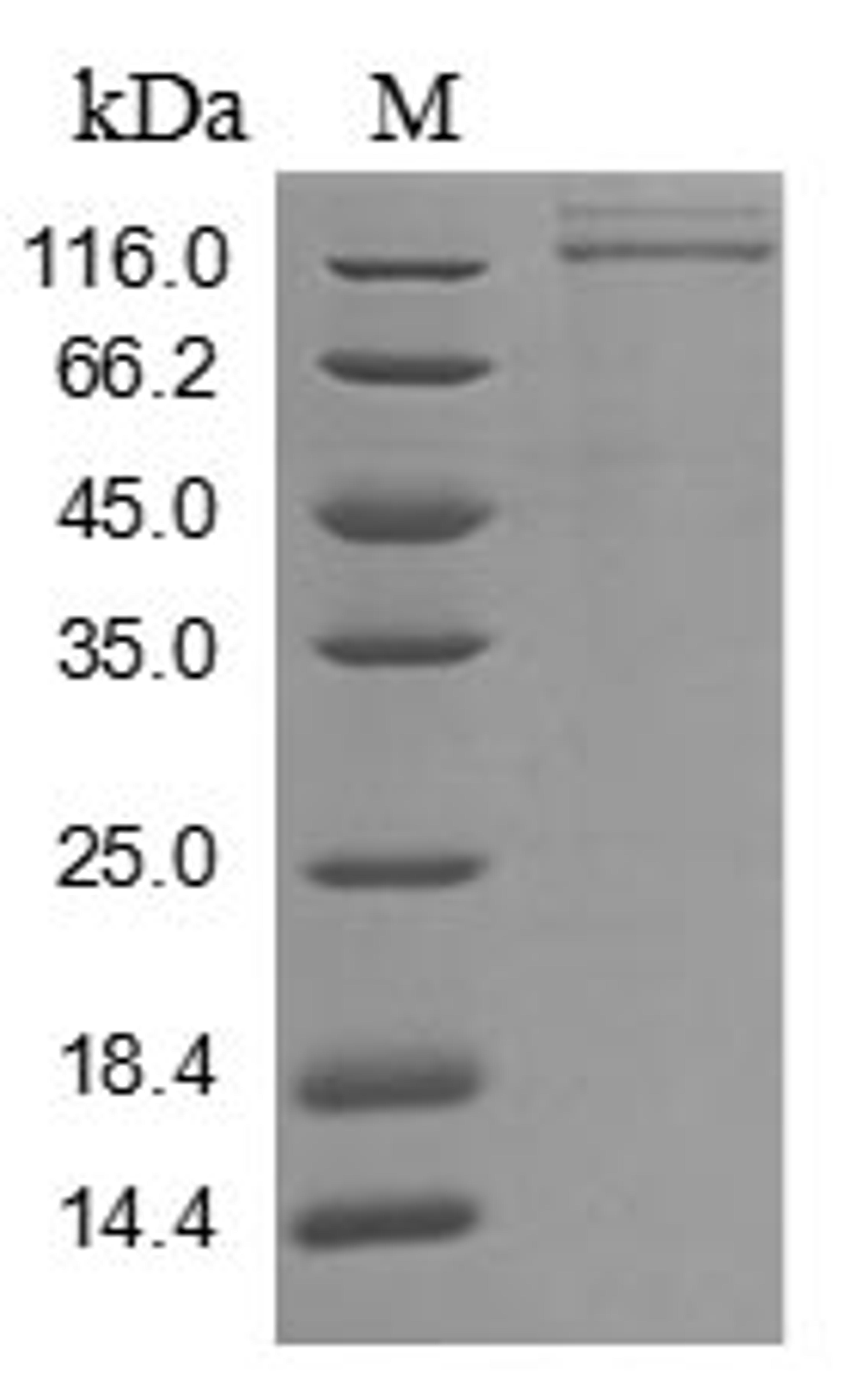 (Tris-Glycine gel) Discontinuous SDS-PAGE (reduced) with 5% enrichment gel and 15% separation gel.