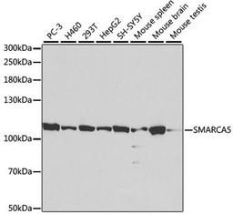 Western blot - SMARCA5 antibody (A2000)