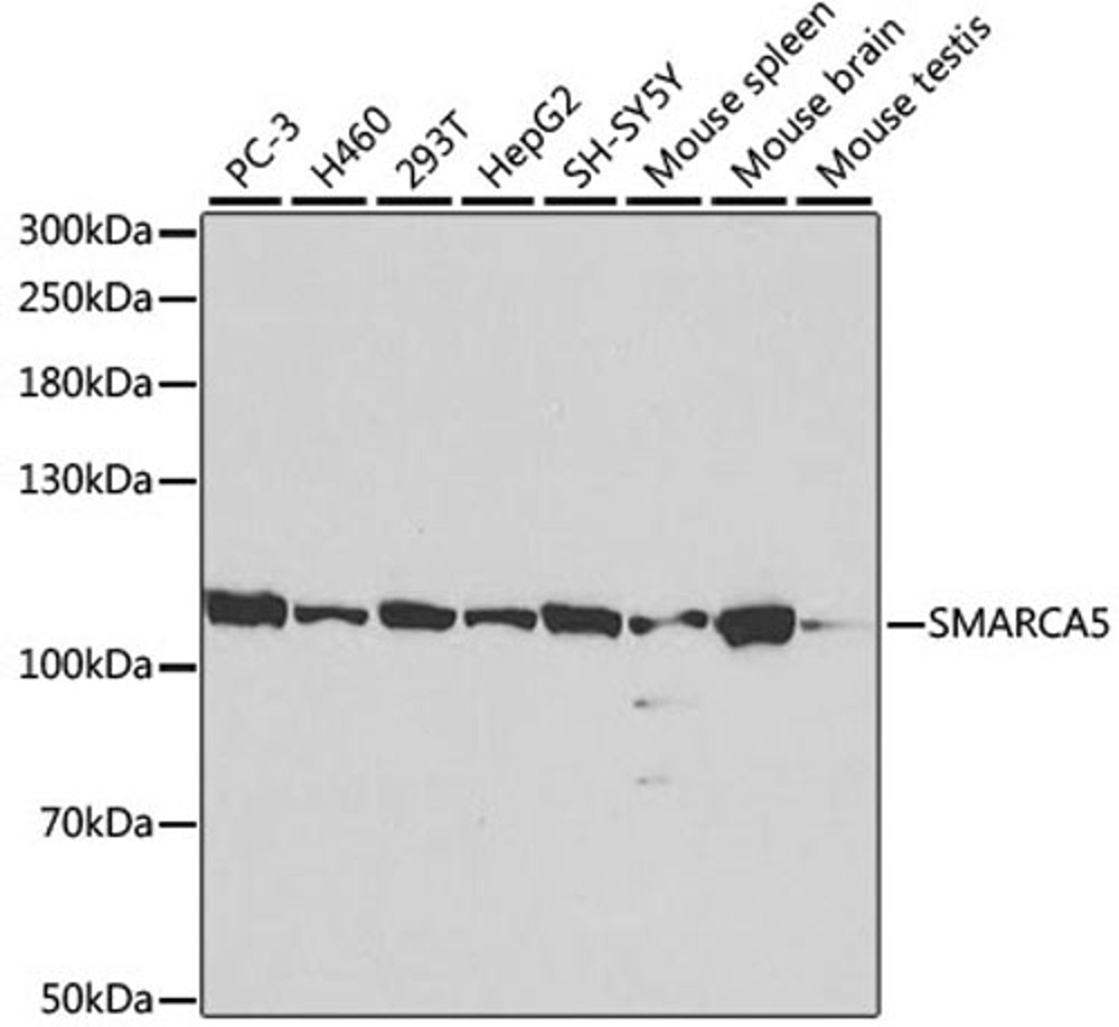 Western blot - SMARCA5 antibody (A2000)