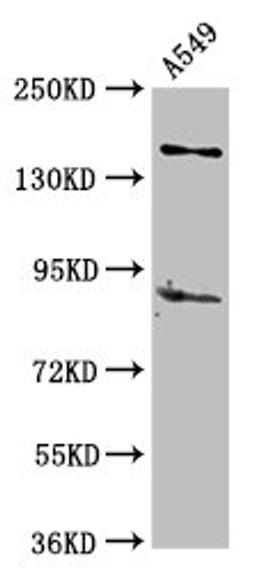 Western Blot. Positive WB detected in: A549 whole cell lysate. All lanes: AFF2 antibody at 5µg/ml. Secondary. Goat polyclonal to rabbit IgG at 1/50000 dilution. Predicted band size: 145, 141, 48, 144, 106 kDa. Observed band size: 145 kDa