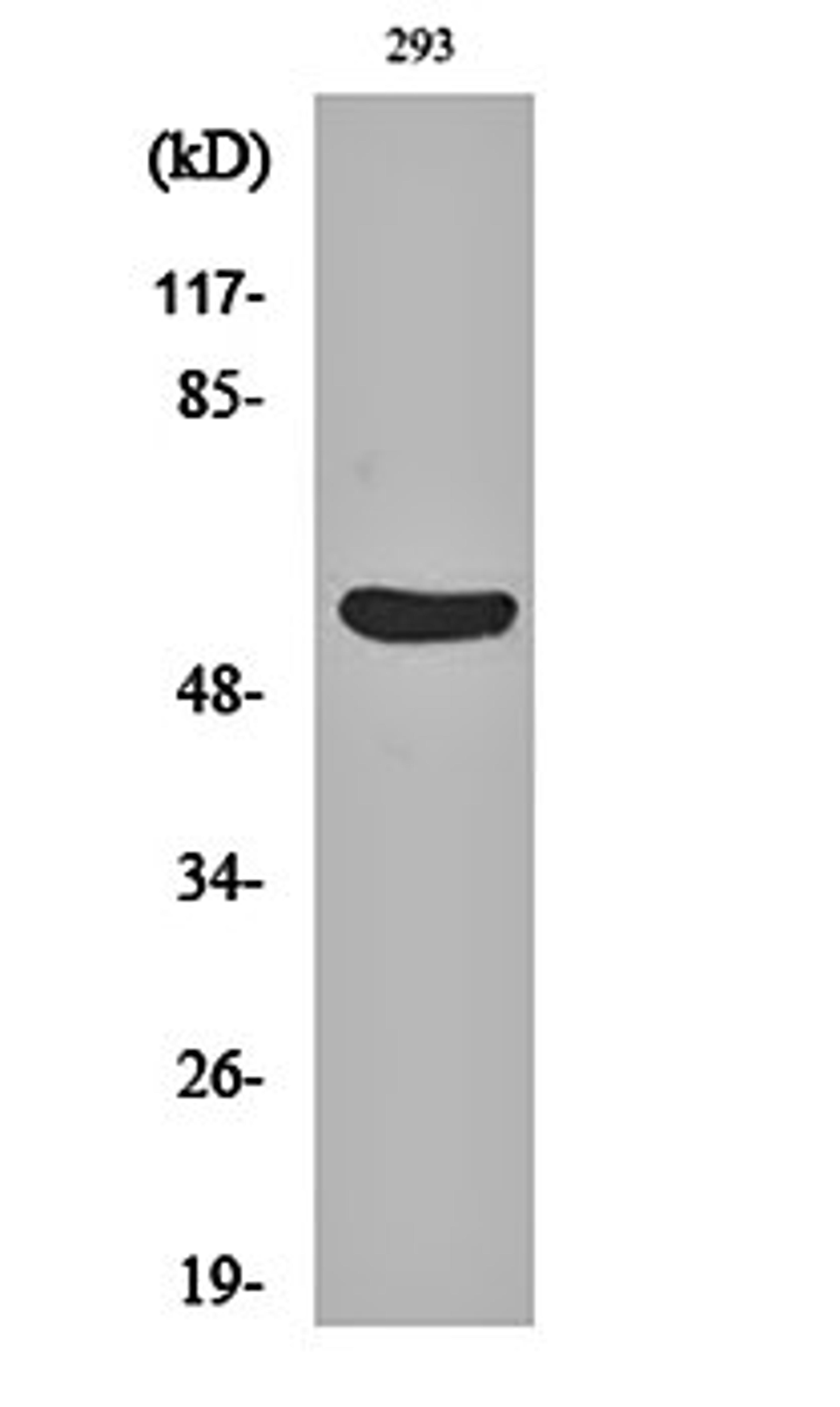 Western blot analysis of 293 cell lysates using Gasdermin C antibody