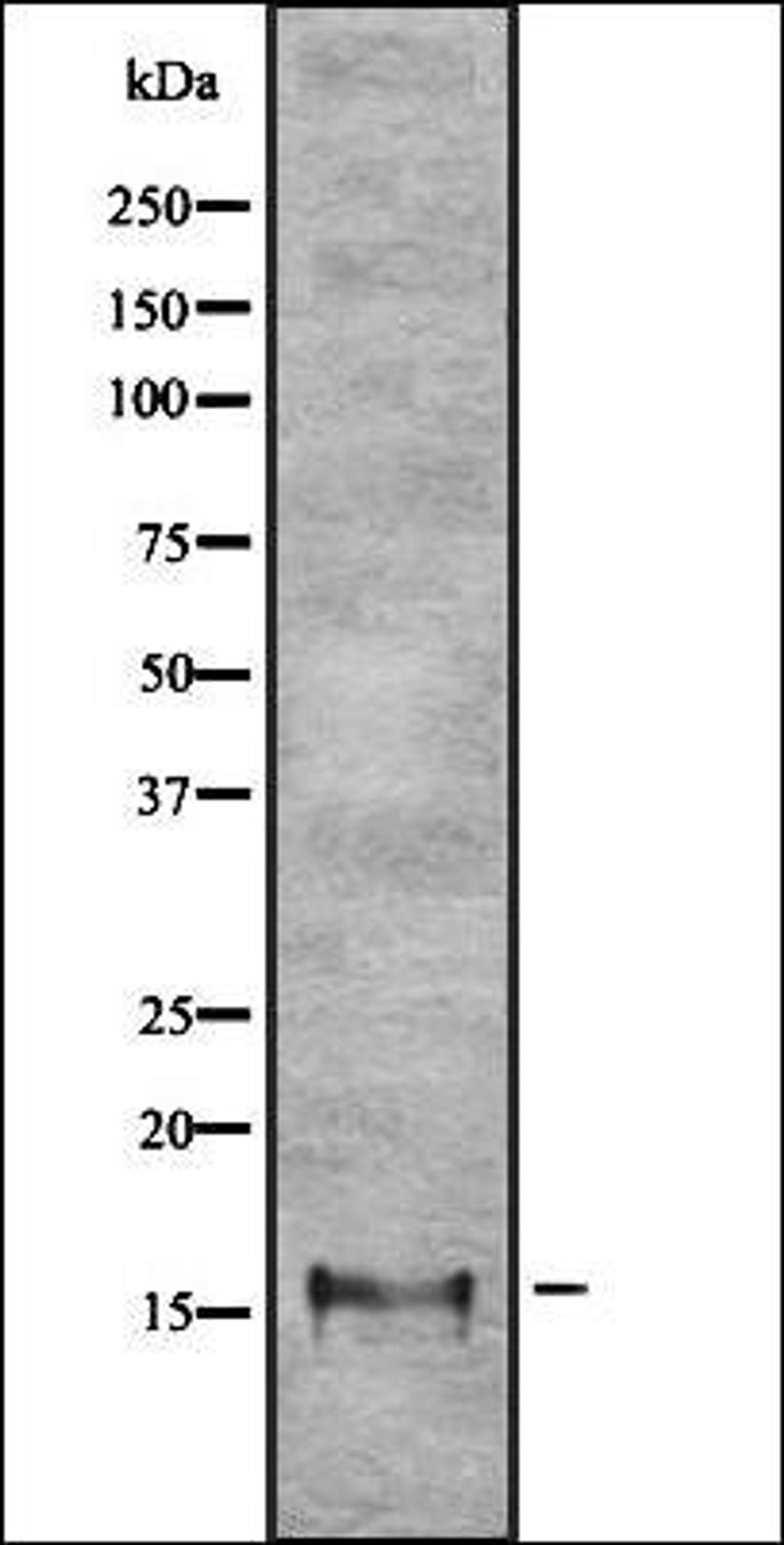 Western blot analysis of HEK293 cells using LPPL antibody