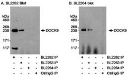 Detection of human DOCK9 by western blot of immunoprecipitates.