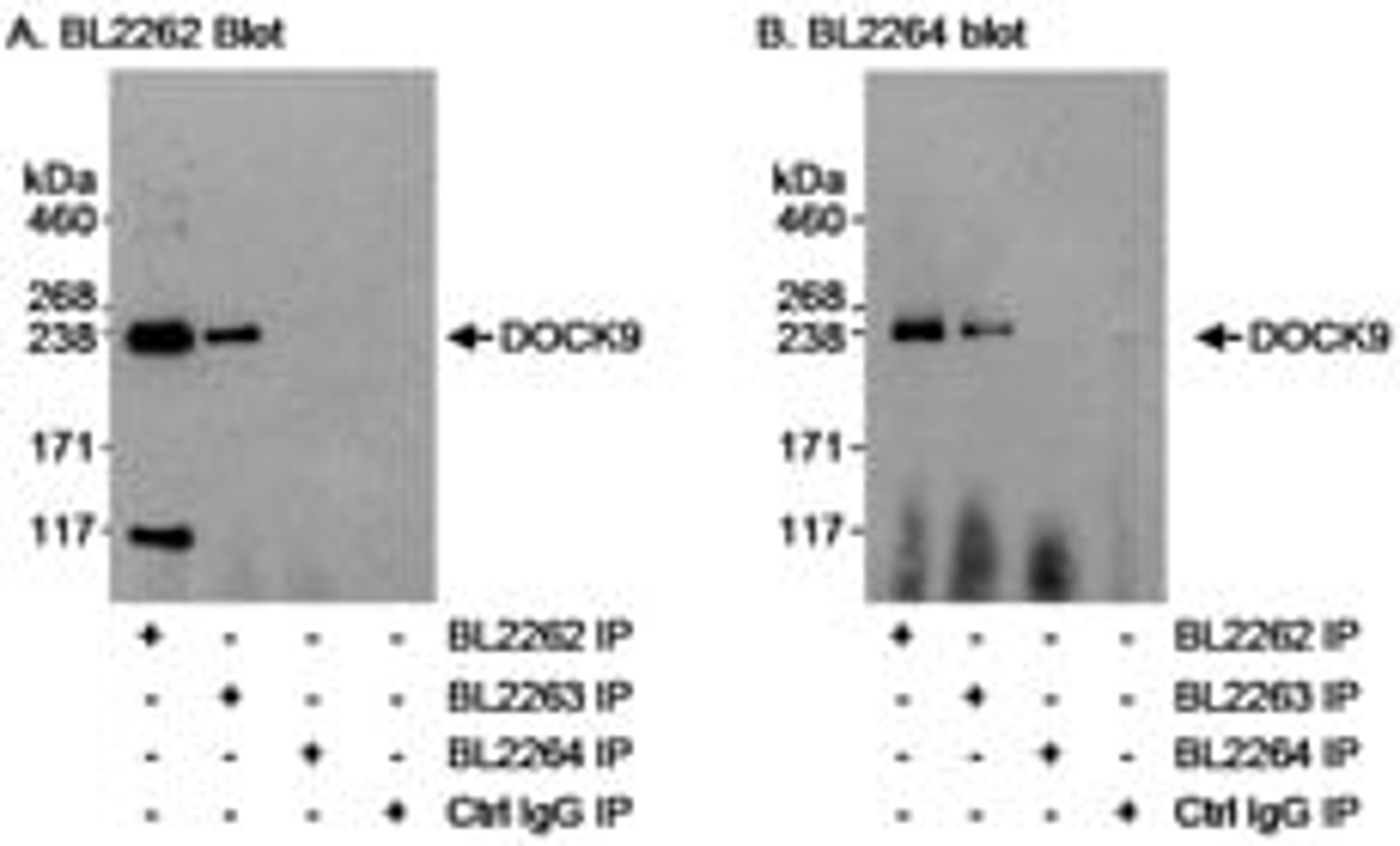 Detection of human DOCK9 by western blot of immunoprecipitates.