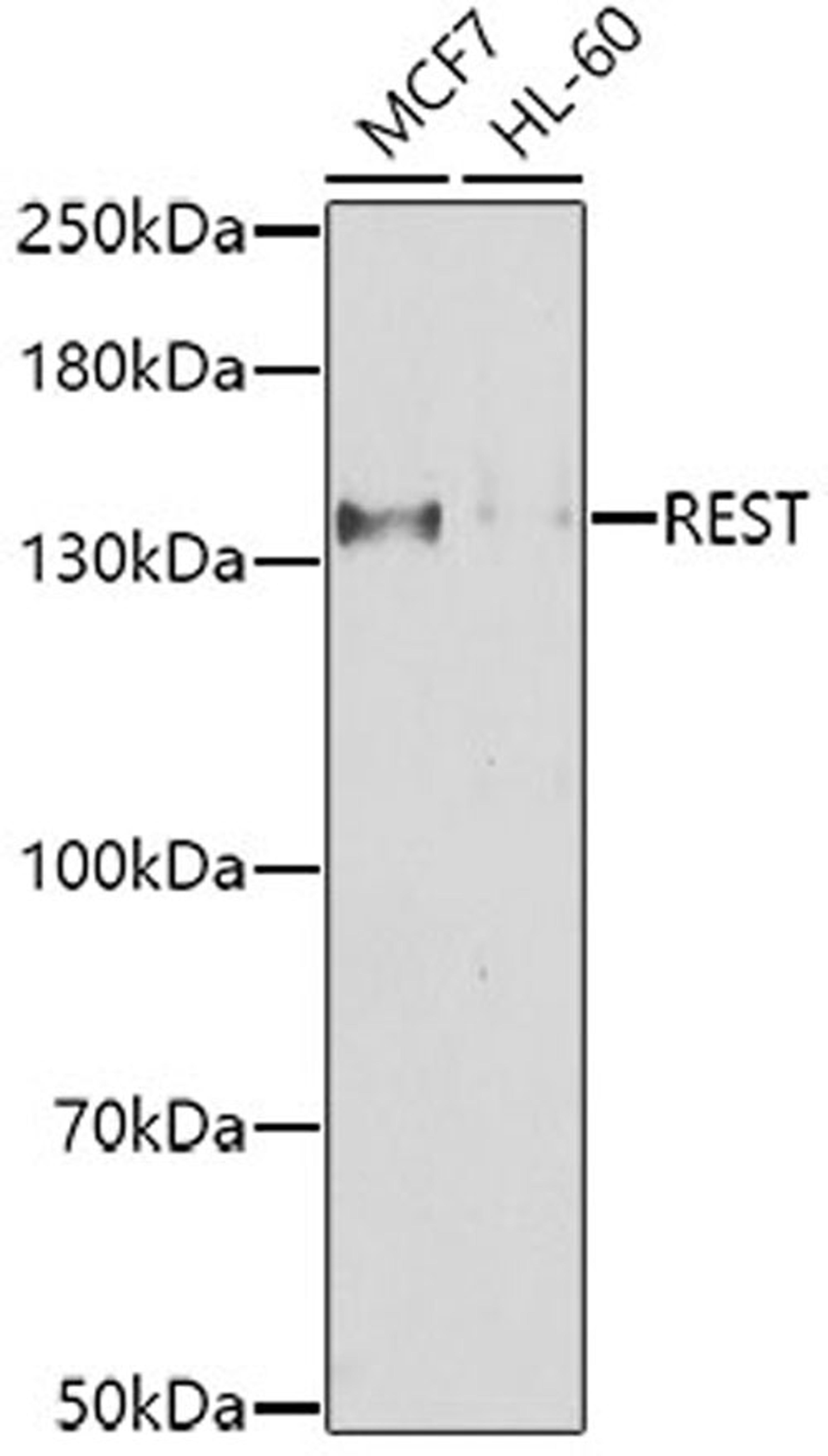 Western blot - REST antibody (A7161)