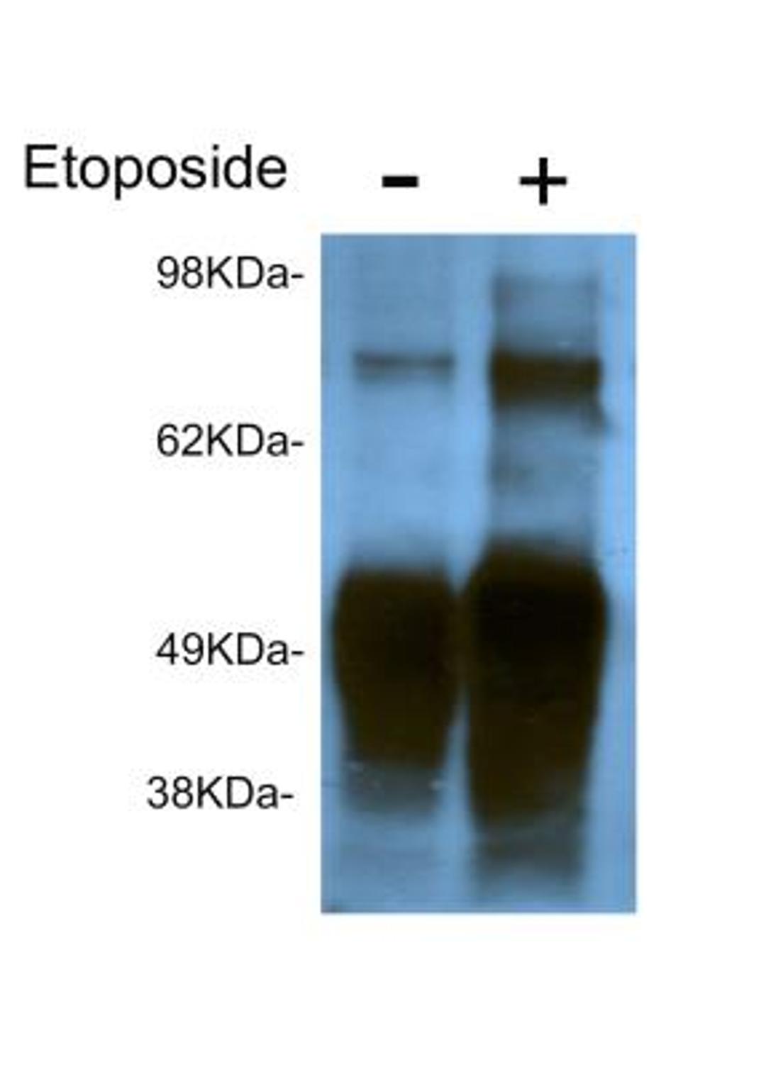 Immunoprecipitation: PARP [p Asp214] Antibody [NBP1-50751] - Immunoprecipitation of HEK293 cells treated with etoposide (5h). Image from verified customer review.