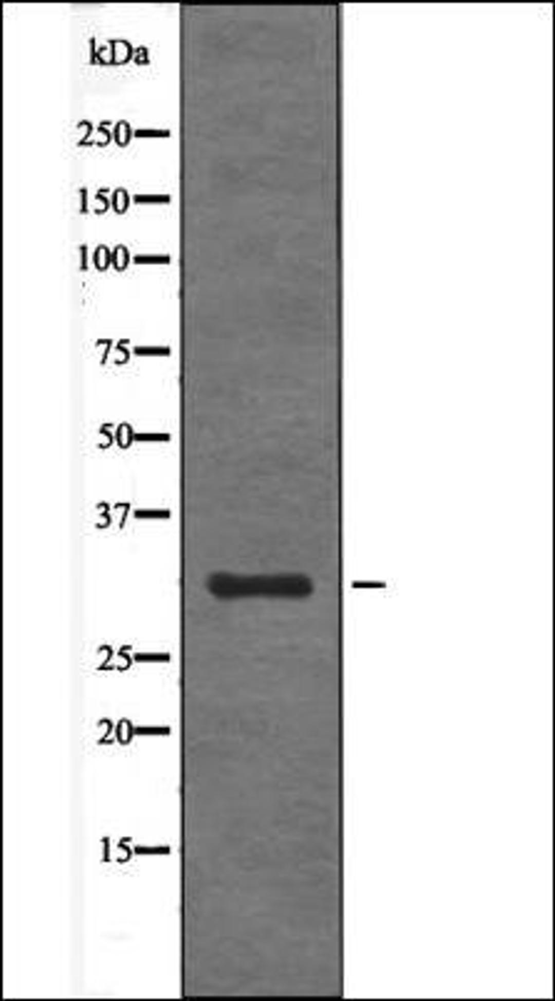 Western blot analysis of TNF- treated HeLa whole cell lysates using BIK -Phospho-Ser35- antibody