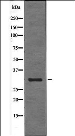 Western blot analysis of TNF- treated HeLa whole cell lysates using BIK -Phospho-Ser35- antibody